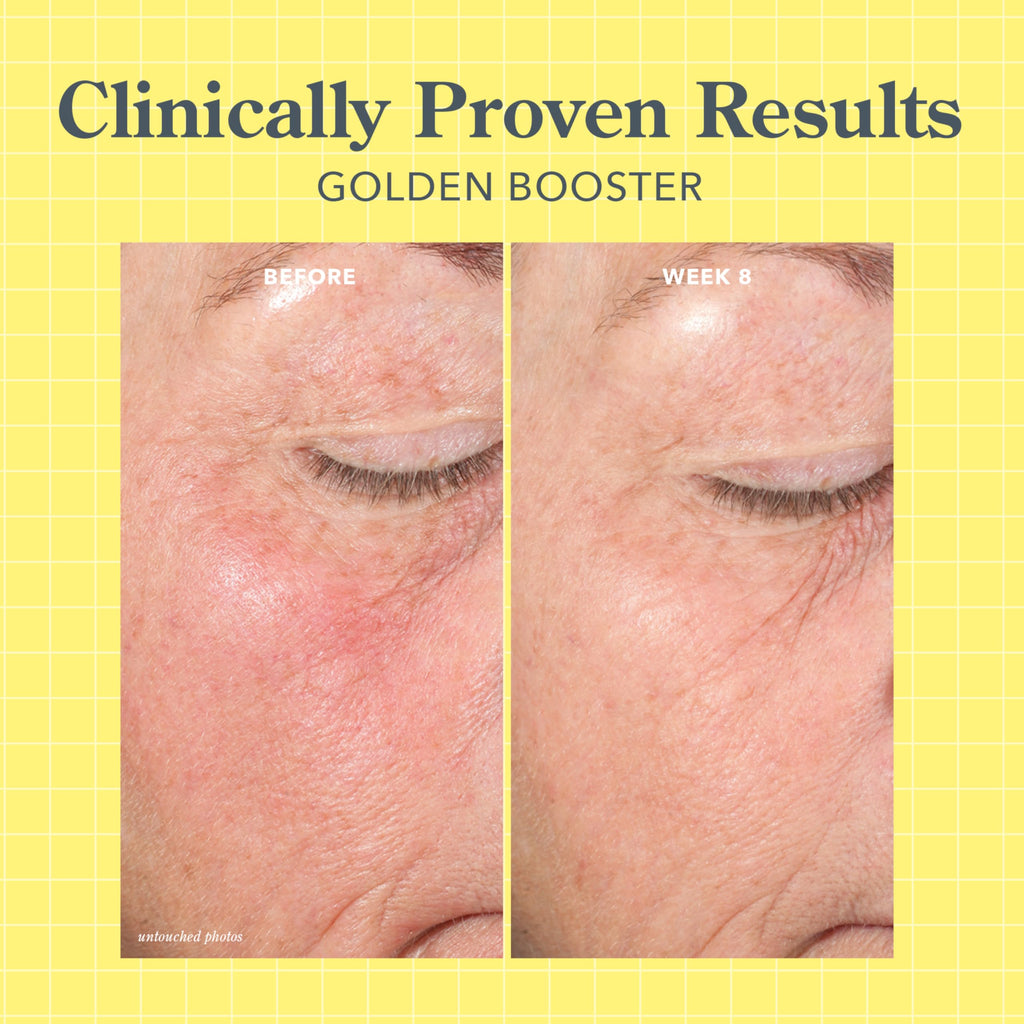 Beekman 1802 Golden Booster Amla Berry Serum – Fragrance Free, Plant-Based Vitamin C for Sensitive Skin | Cruelty Free, 1 fl oz