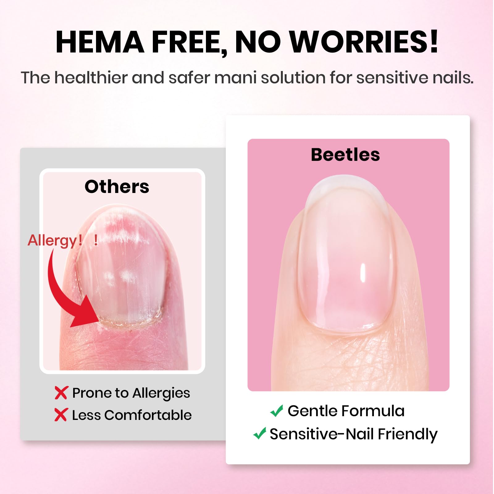 Beetles Etch-X Gel Nail Kit: 288pc Short Square Tips, 12 Sizes, HEMA-Free Base/Top Coat & Glue – DIY Nails at Home