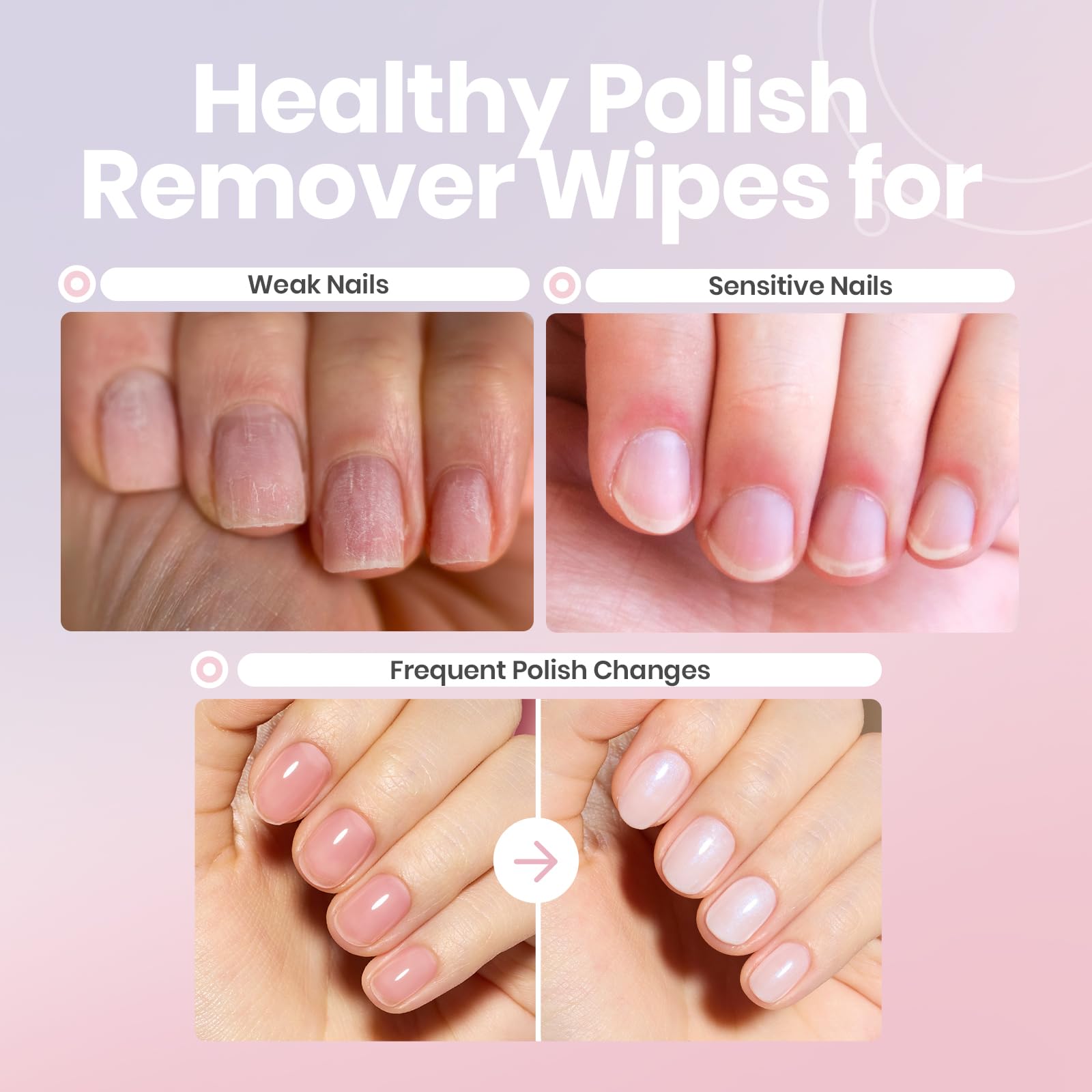 Beetles Nail Polish Remover Pads – 100 Count, 2-in-1 Prep & Lacquer Remover with Vitamin E