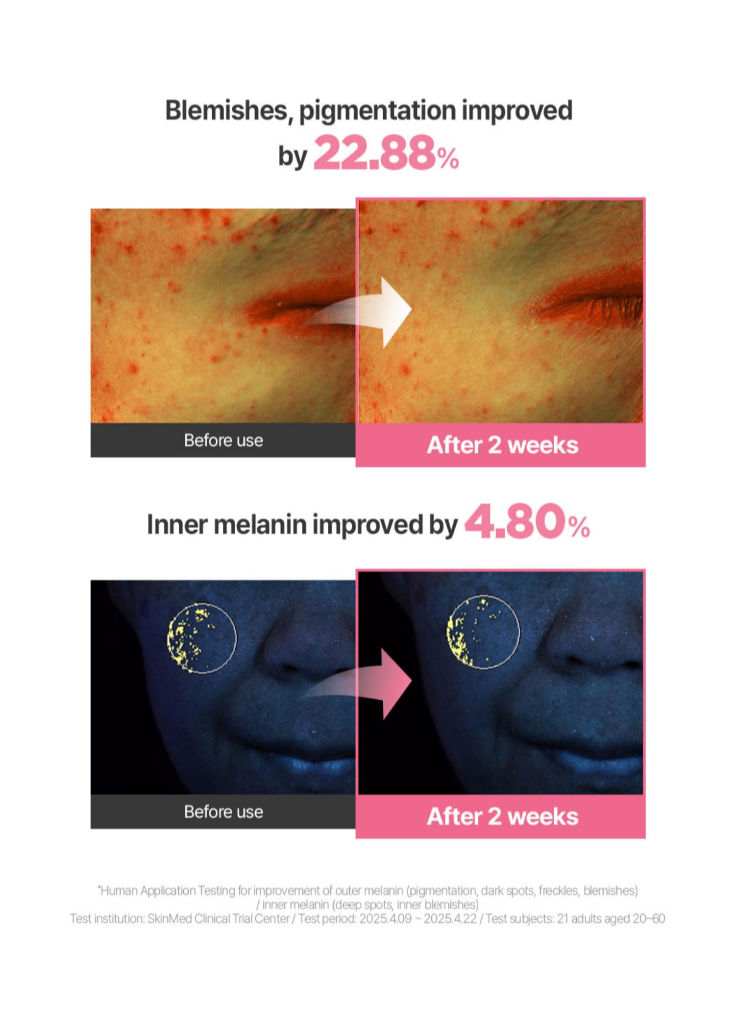 BeginS by JUNGSAEMMOOL Pink Guava Glutathione Blemish Cream – Lightweight Moisturizer with 99% Glutathione, Niacinamide & Vitamin C