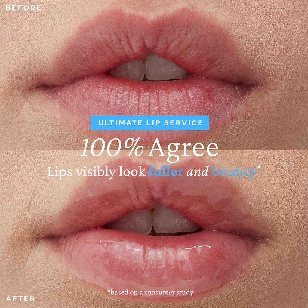 Belif Super Knights Lipcerin Lip Balm | Hyaluronic Acid & Vitamin C | Hydration & Plumping