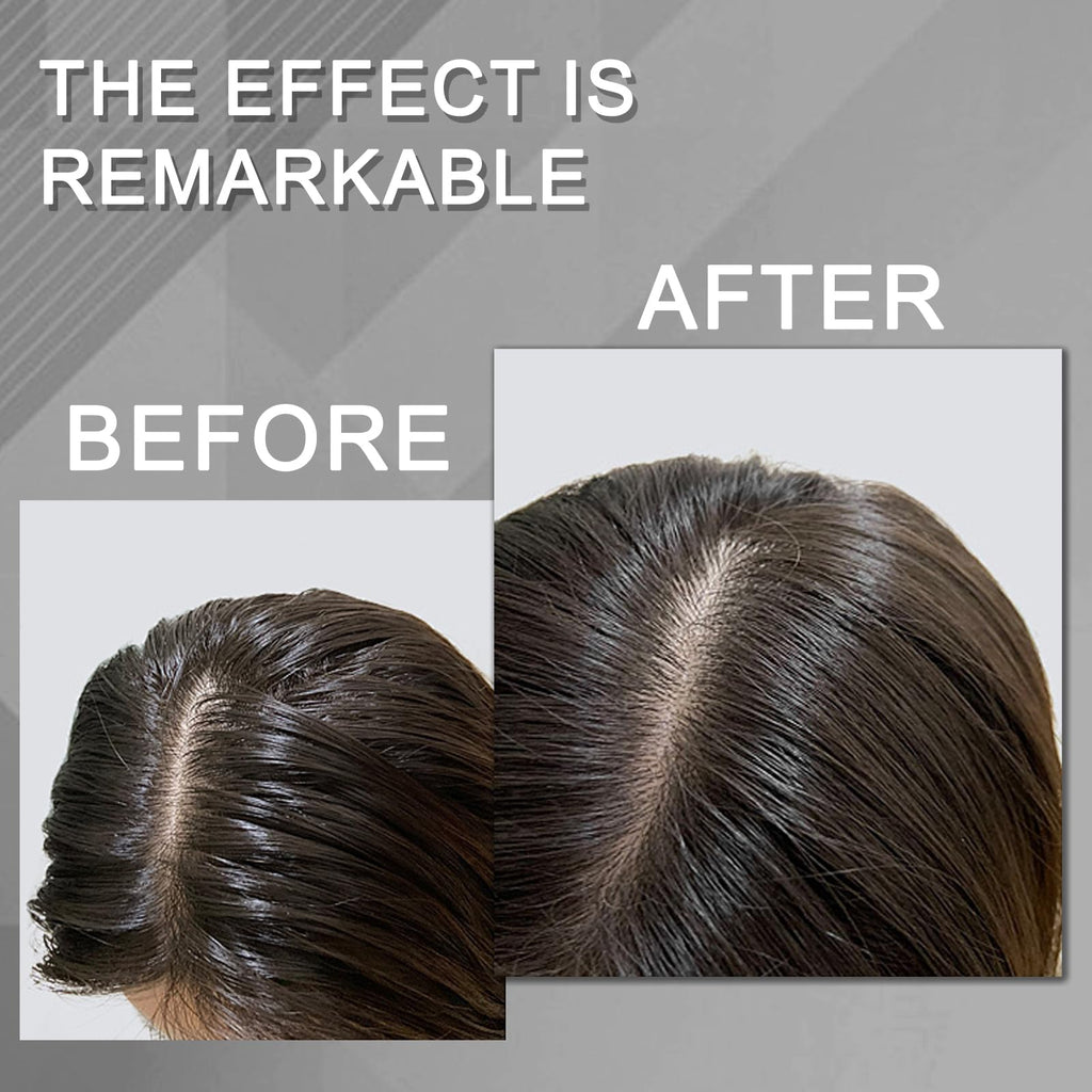 BENIX Dry Shampoo – Volumizing Spray for All Hair Types | Invisible Formula, No White Residue, 5 Oz