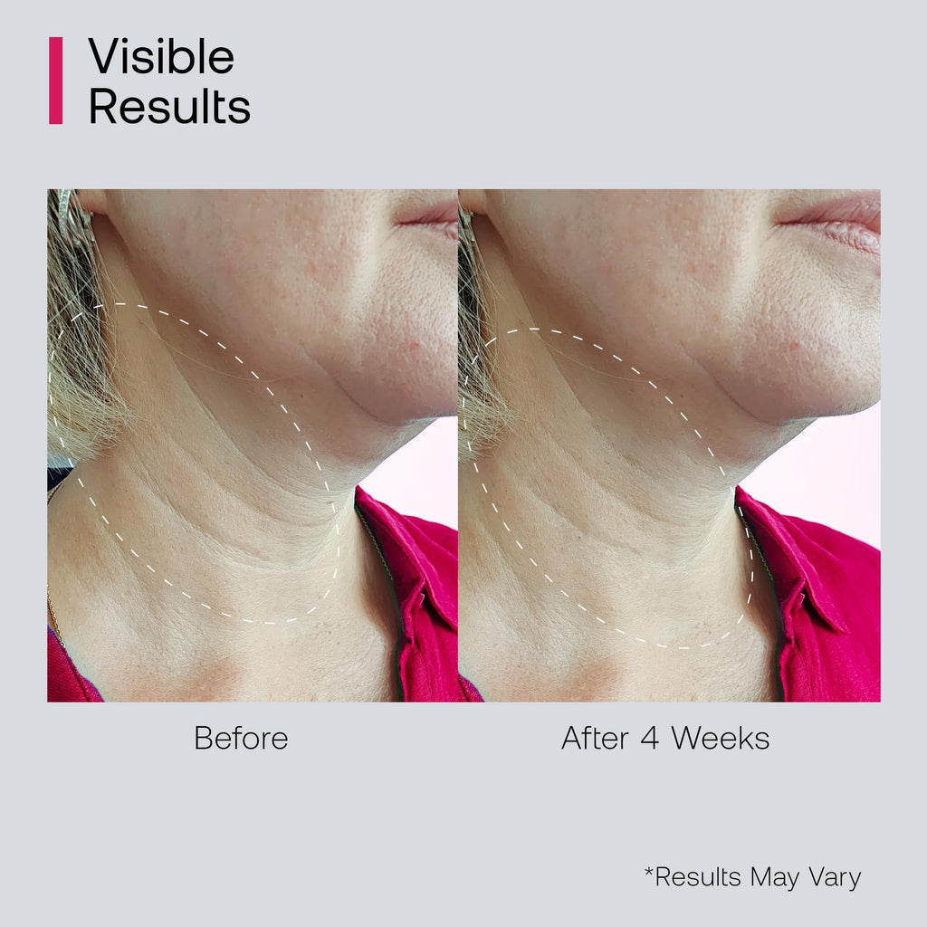 Bestkiss Neck Cream for Tightening & Firming with Roller Applicator | Retinol, Niacinamide & Hyaluronic Acid
