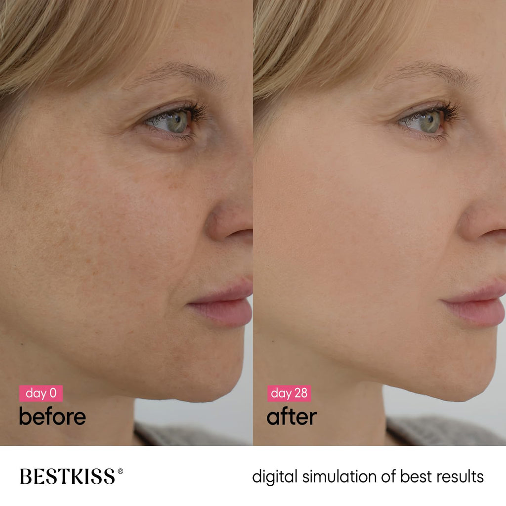 Bestkiss Dark Spot Serum with Niacinamide 10% + Tranexamic 5% + Alpha-Arbutin 2% – 1 oz
