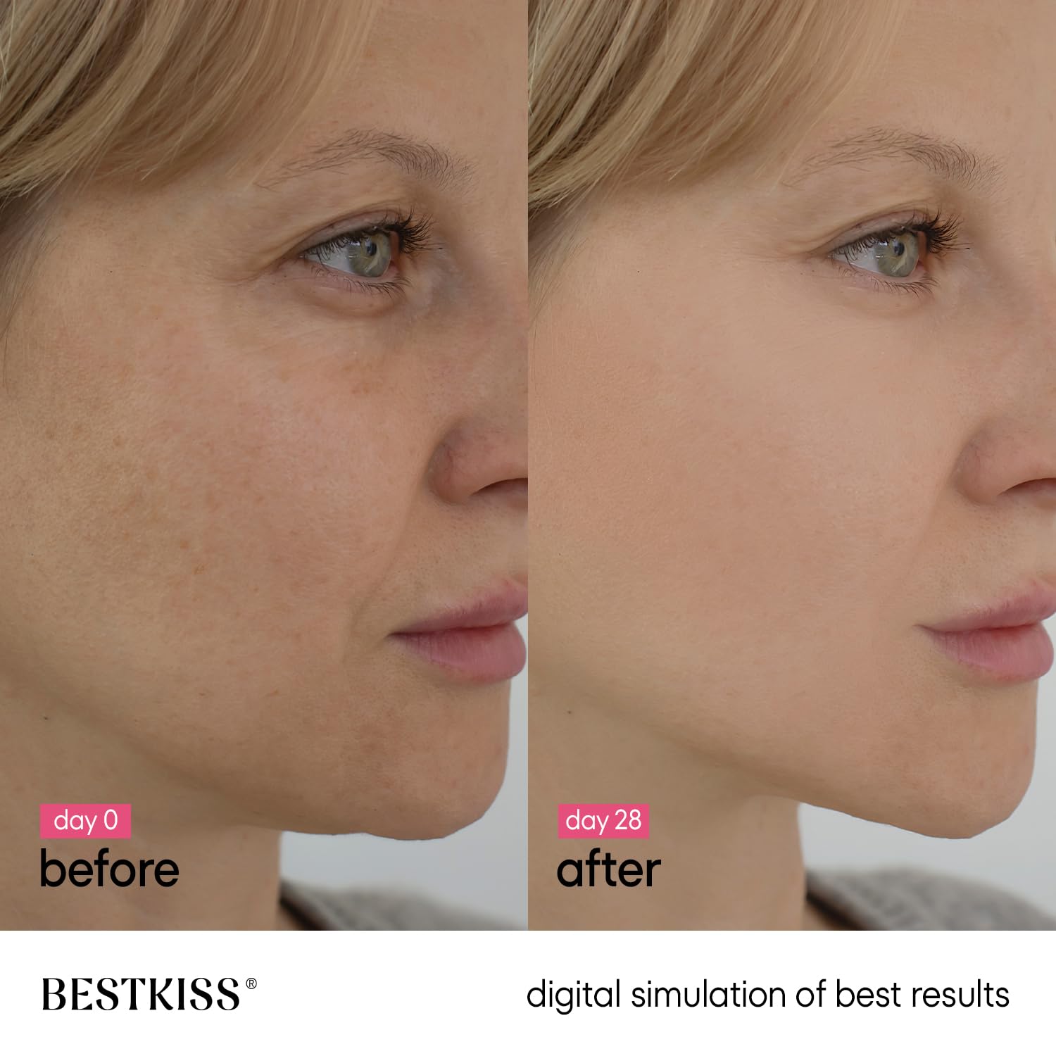 Bestkiss Dark Spot Serum with Niacinamide 10% + Tranexamic 5% + Alpha-Arbutin 2% – 1 oz