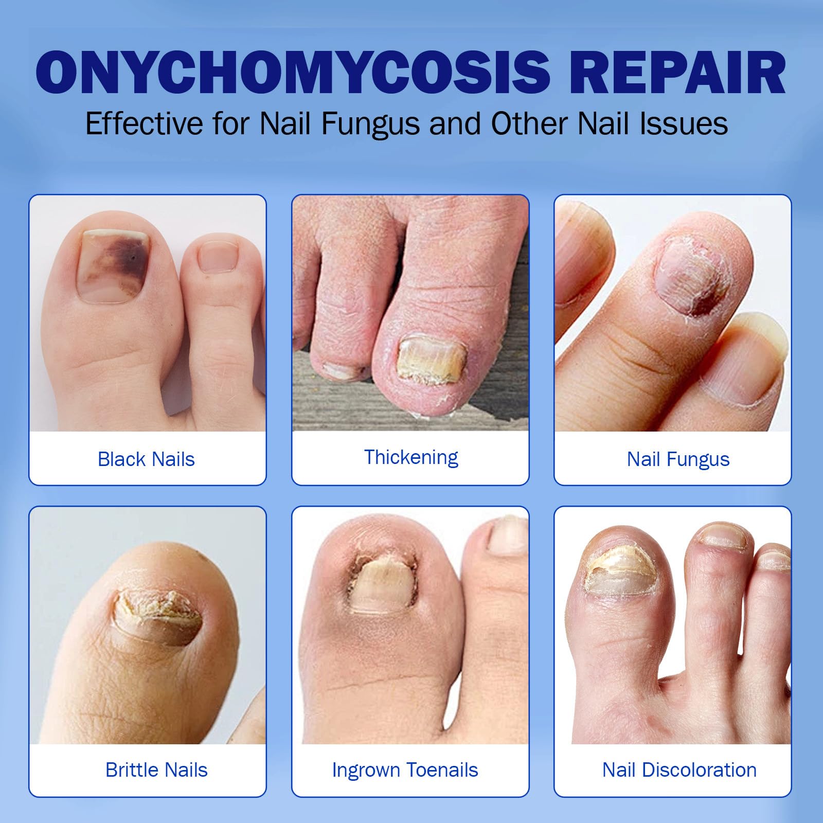 BFGCKJ Fungal Nail Patches for Toenails – 42 Count, 8-Hour Overnight Adhesion