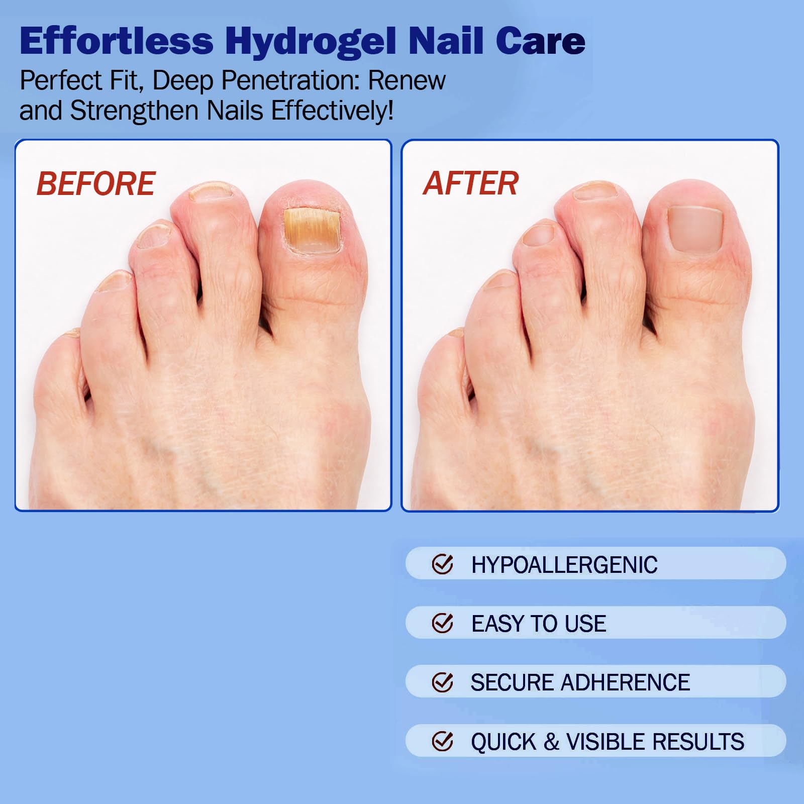 BFGCKJ Fungal Nail Patches for Toenails – 42 Count, 8-Hour Overnight Adhesion
