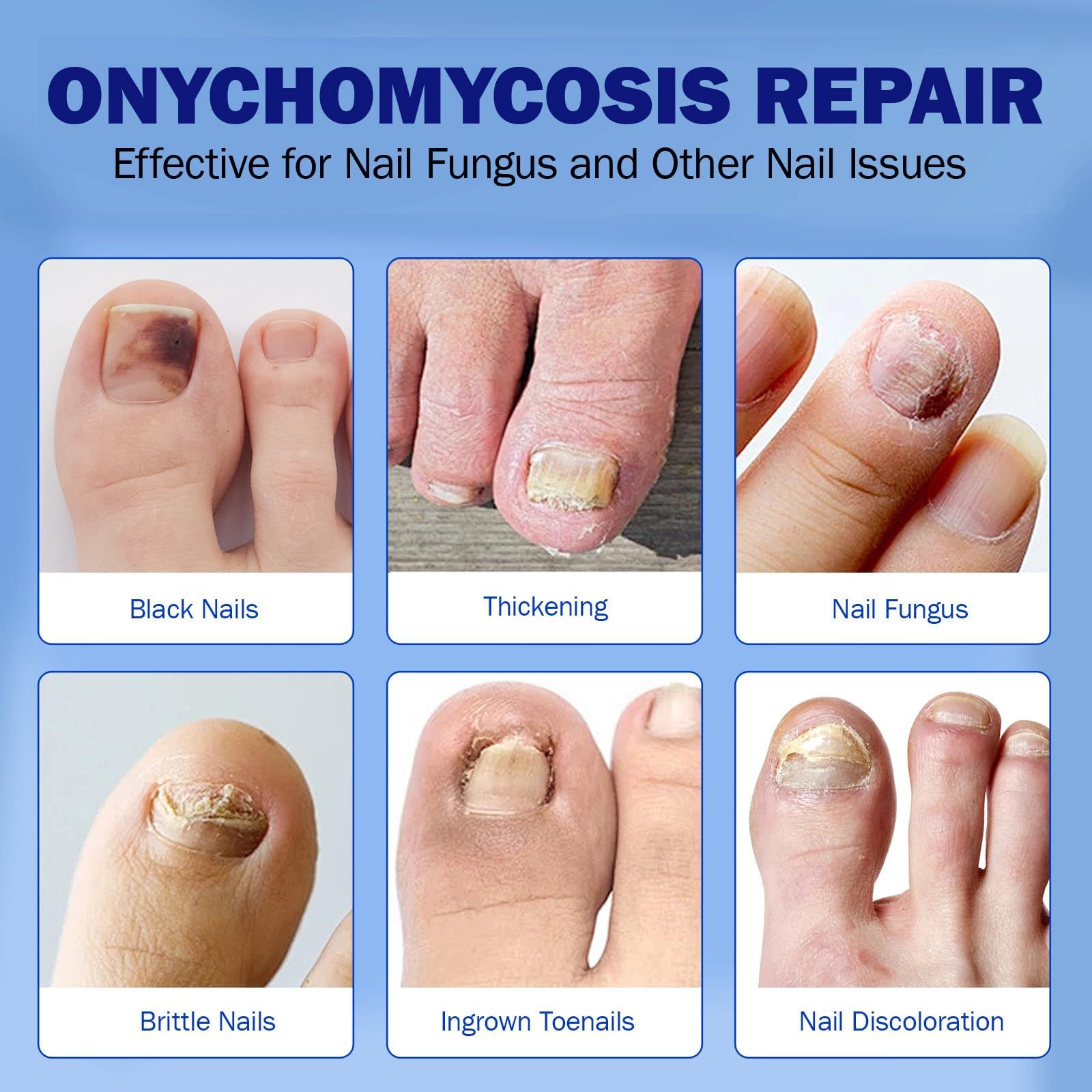 BFGCKJ Fungal Nail Patches for Toenails – 21-Count, Overnight Renewal