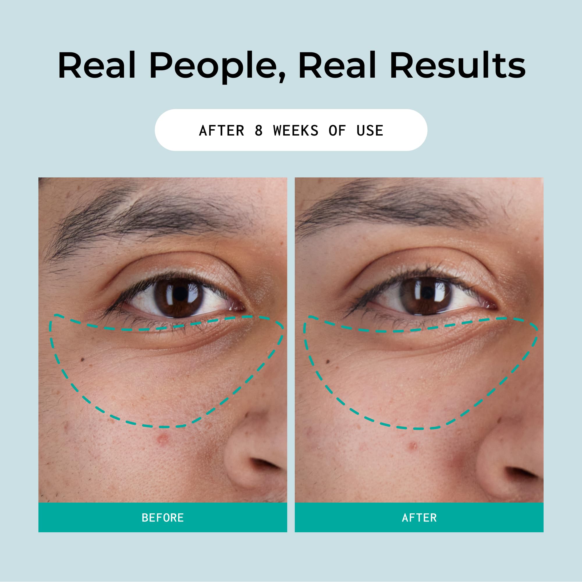 Bigger Than Beauty Skincare Defying Gravity Eye Lifting Cream – Plant-Based Retinol, Green Tea, Vegan & Cruelty-Free