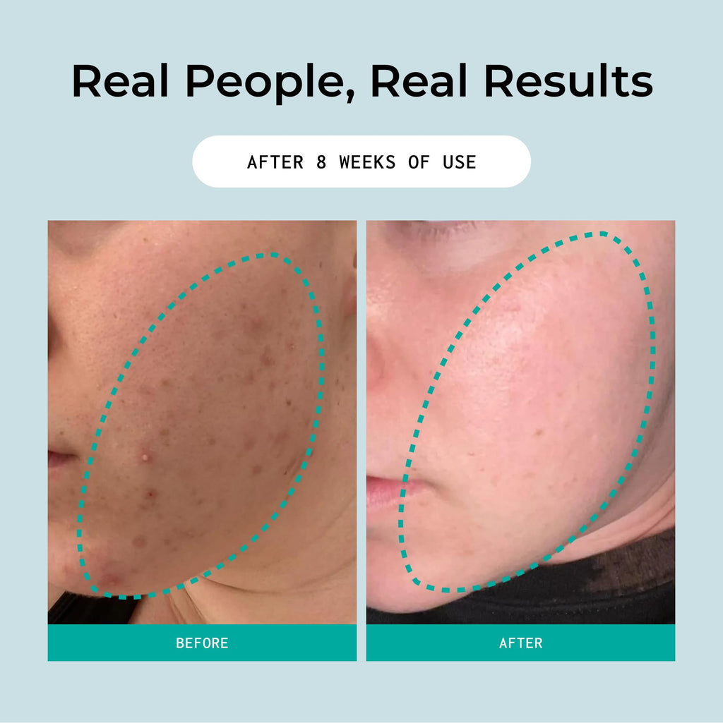 Bigger Than Beauty Skincare Overnight Sensation – Gentle Retexturizing Solution