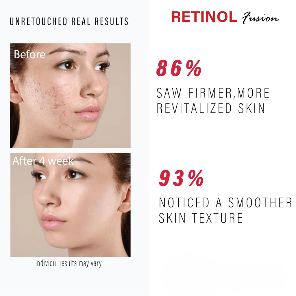 Bio Mystery Retinol 0.05% Fusion Cream with Bakuchiol – Gentle Anti-Aging for Sensitive Skin – 40g / 1.41 oz