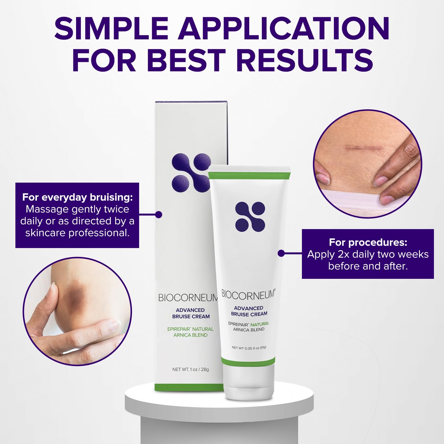 BIOCORNEUM Advanced Bruise Cream 1oz – Arnica & Vitamin K for Visible Skin Recovery