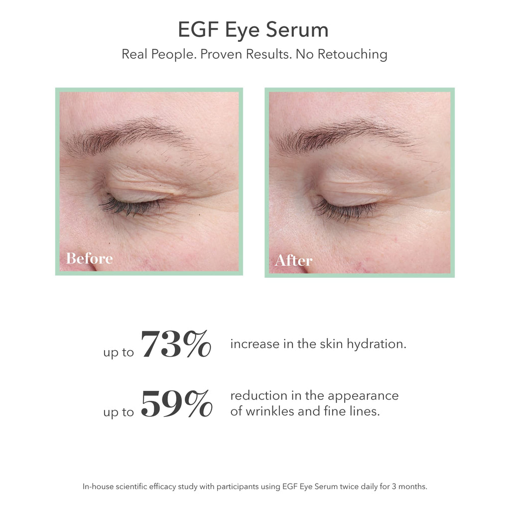Bioeffect EGF Eye Serum with De-Puffer Rollerball – Age-Defying Under-Eye Care (12 mL total)