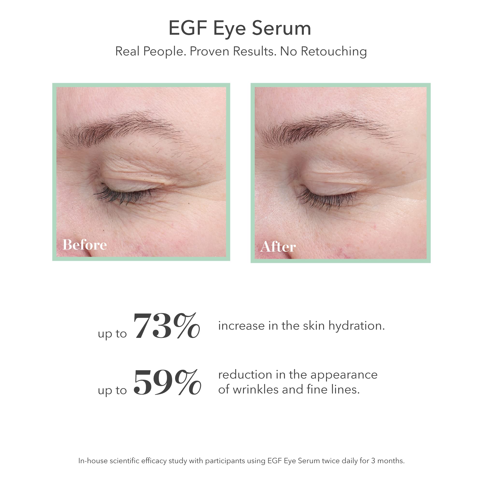 Bioeffect EGF Eye Serum with De-Puffer Rollerball – Age-Defying Under-Eye Care (12 mL total)