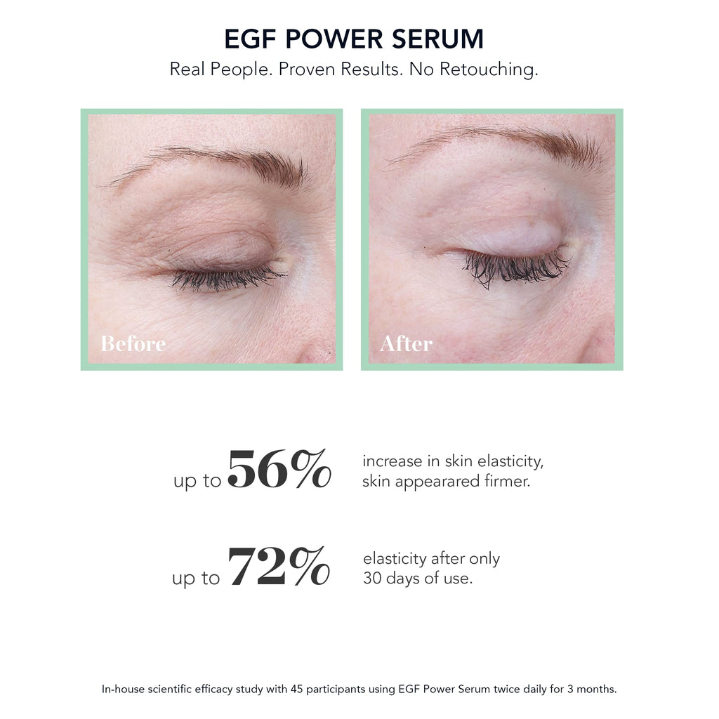 BIOEFFECT EGF Power Serum | Growth Factor Serum with EGF, KGF & Hyaluronic Acid | 15 mL