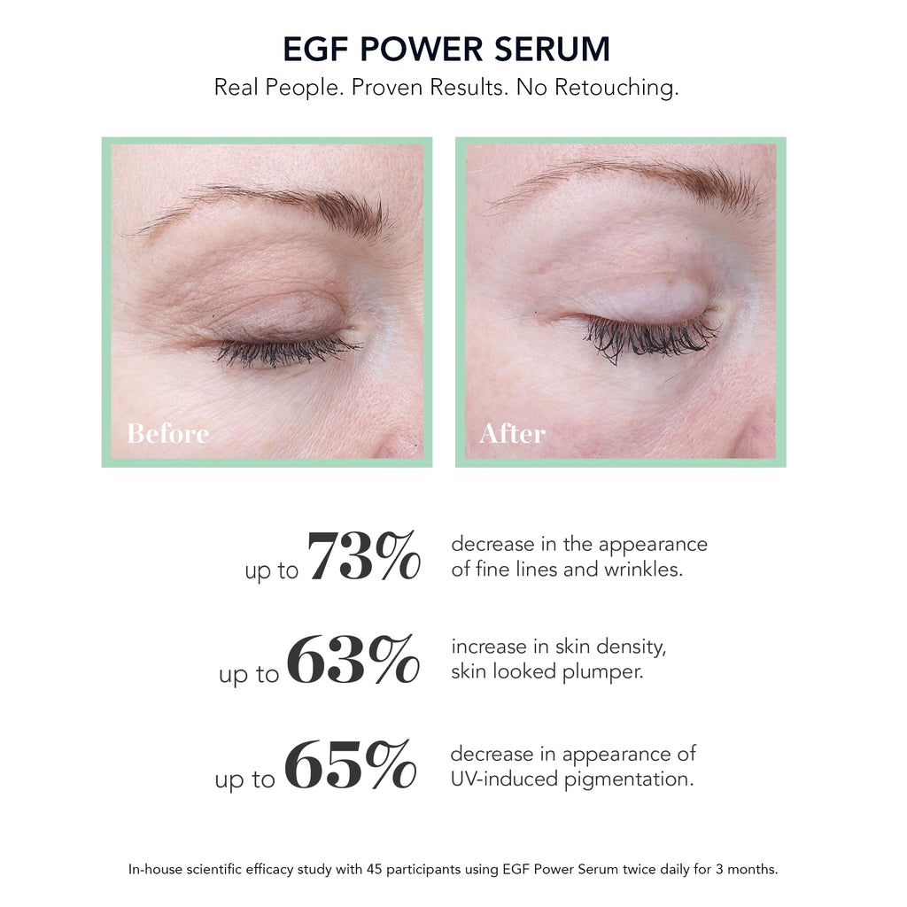 BIOEFFECT EGF Power Serum | Growth Factor Serum with EGF, KGF & Hyaluronic Acid | 15 mL