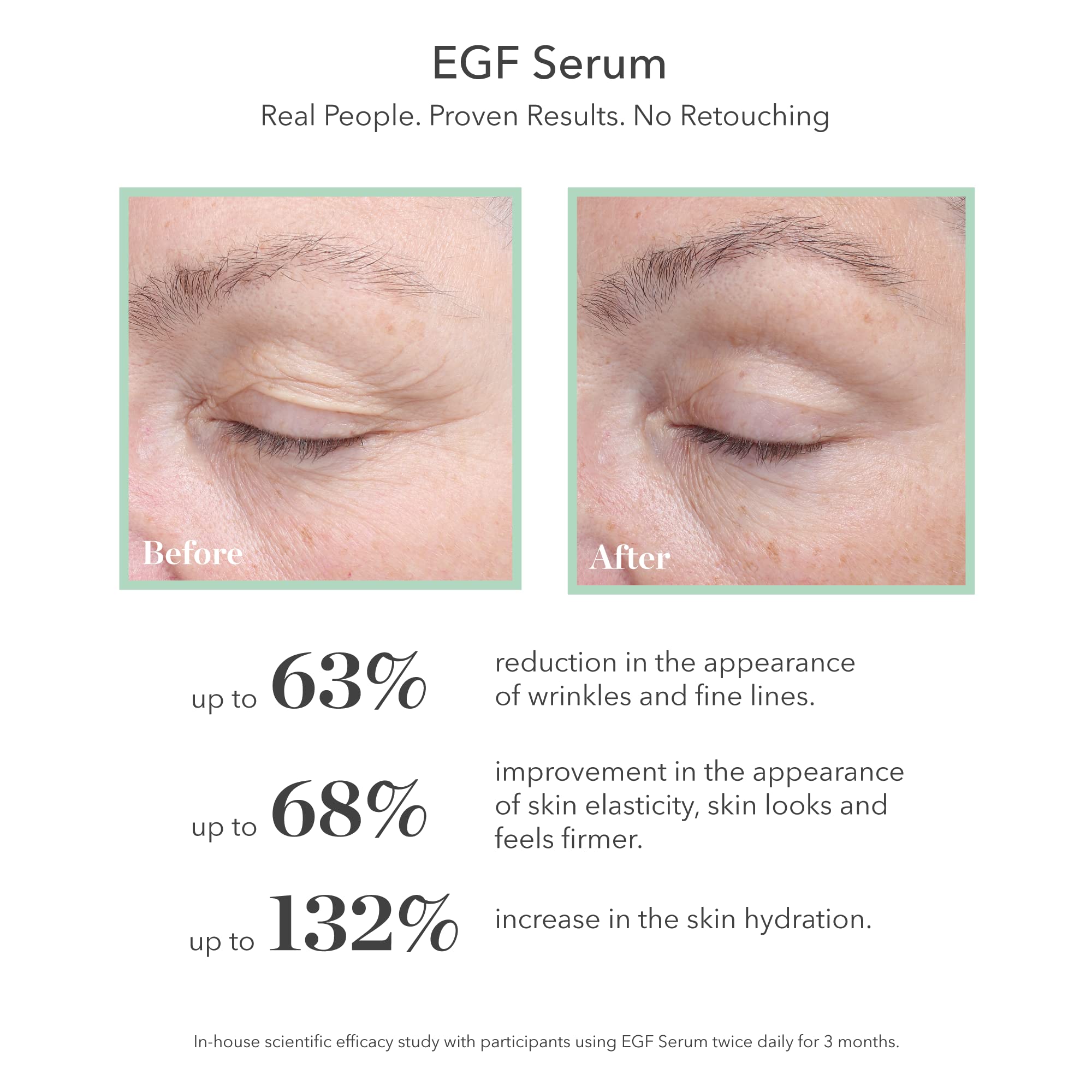BIOEFFECT EGF Serum | Barley Growth Factor + Hyaluronic Acid for Hydration, Firmness & Smooth Skin | 20 mL