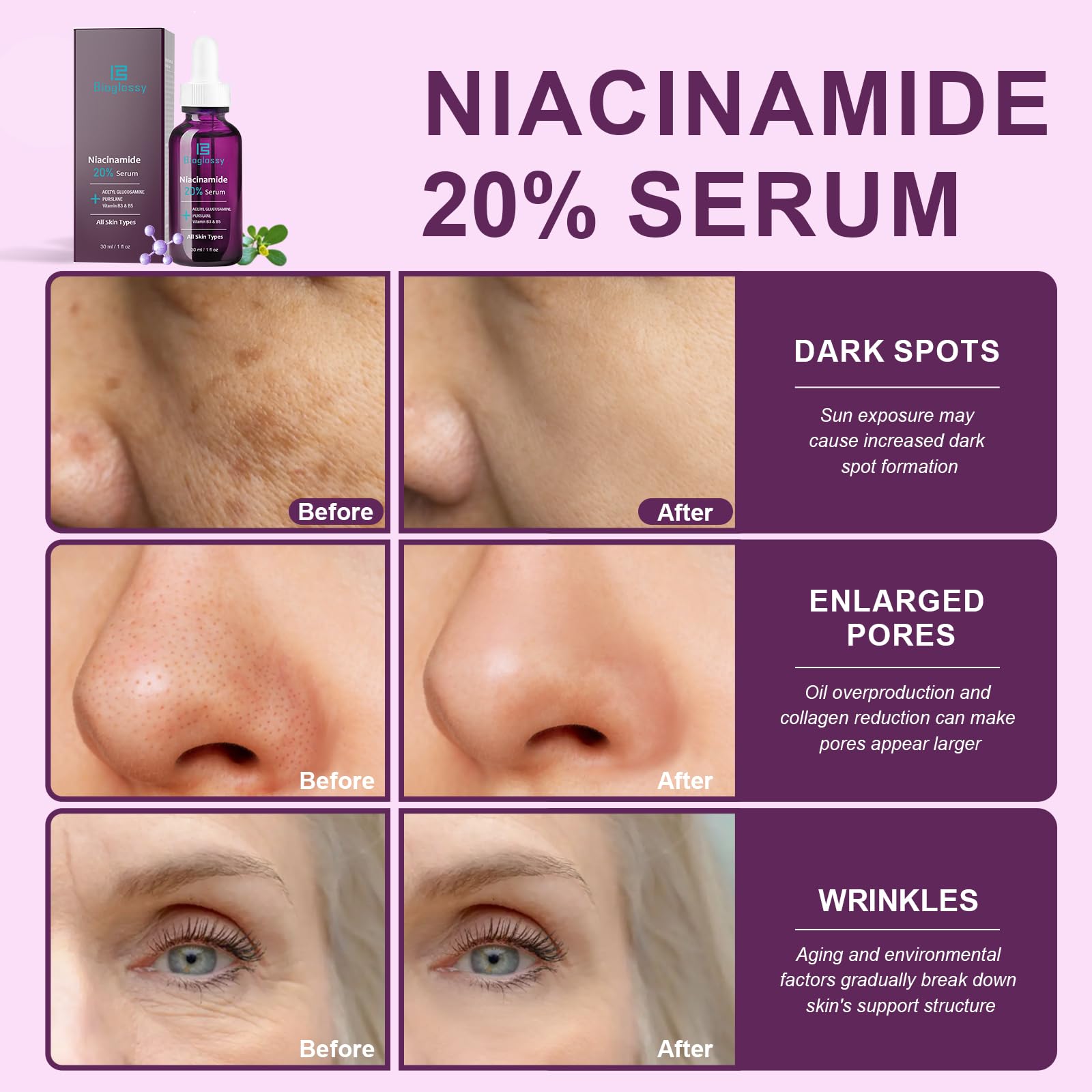 Bioglossy 20% Niacinamide Serum for Face – Brightening, Pore Refining & Hydration