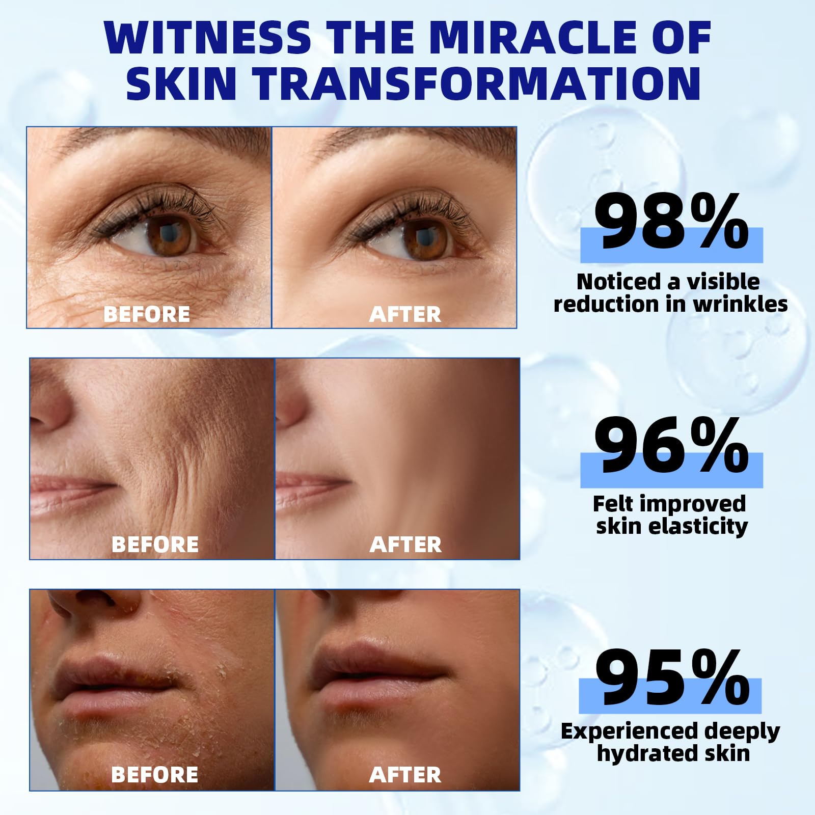 Bioglossy Retinol Serum for Face – 2.5% Time-Release Night Serum with Squalane, Vitamin C & E, Niacinamide, and Hyaluronic Acid (30 ml)