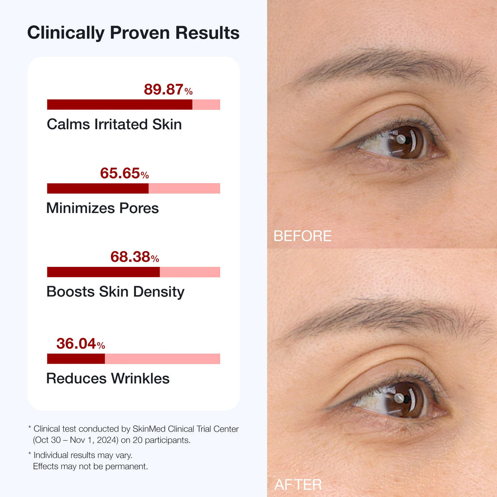 BIOOA PDRN Teedle Shot 300 Spicule Microneedling Serum | Minimize Pores & Fine Lines