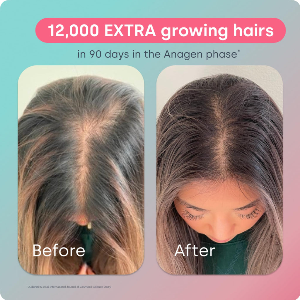 BioSil Advanced Hair Growth Formula | 30 Packets | Patented ch-OSA for Thicker, Stronger Hair