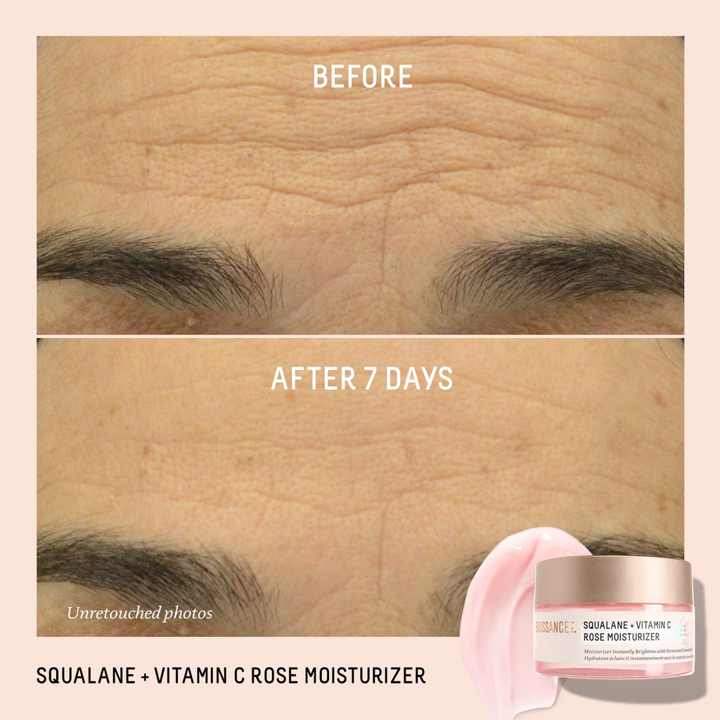BIOSSANCE Squalane + Vitamin C Rose Moisturizer – Hydration, Brightening & Smooth Texture
