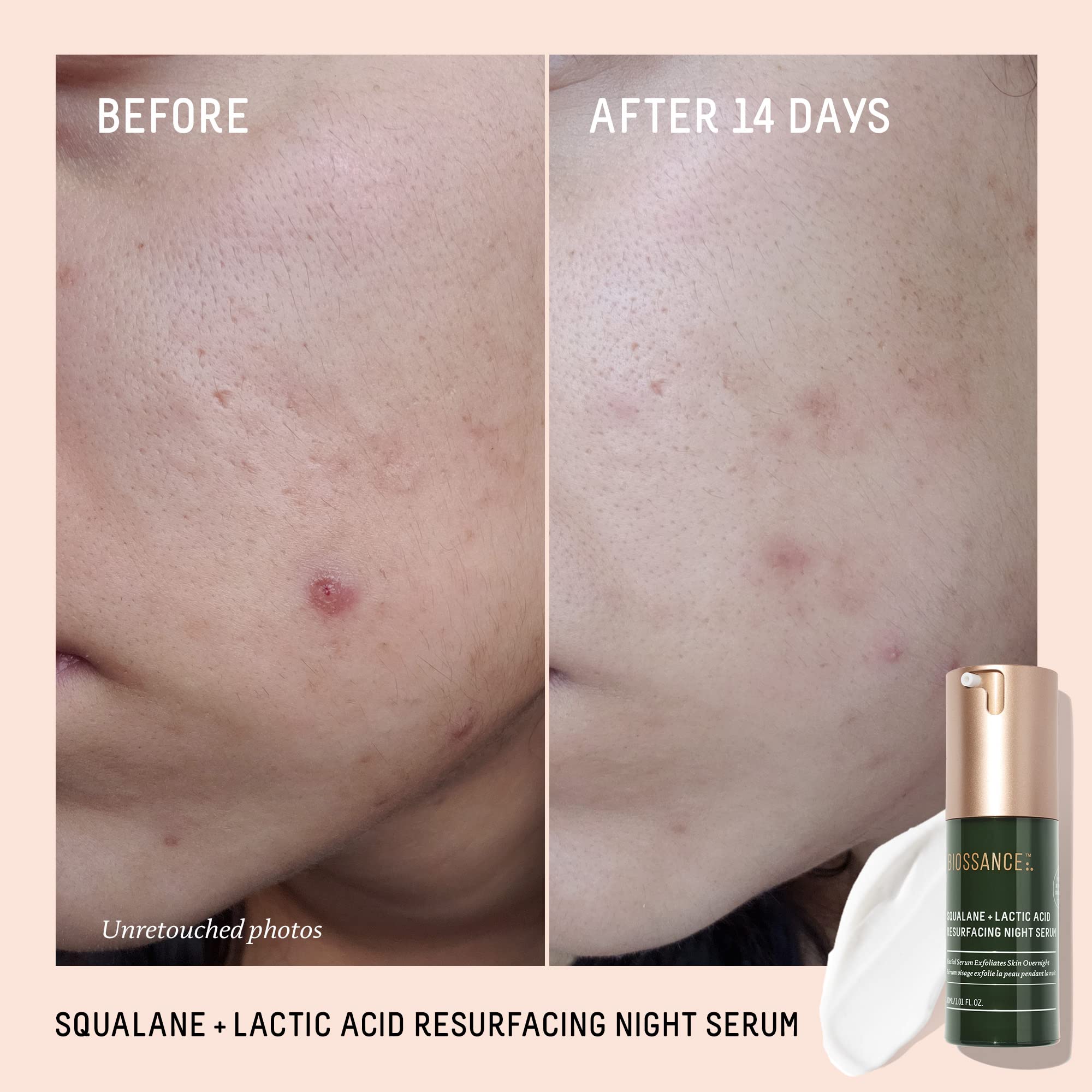 BIOSSANCE Squalane + Lactic Acid Night Serum – 10% Vegan Exfoliant for Texture, Hydration & Glow (1 oz)