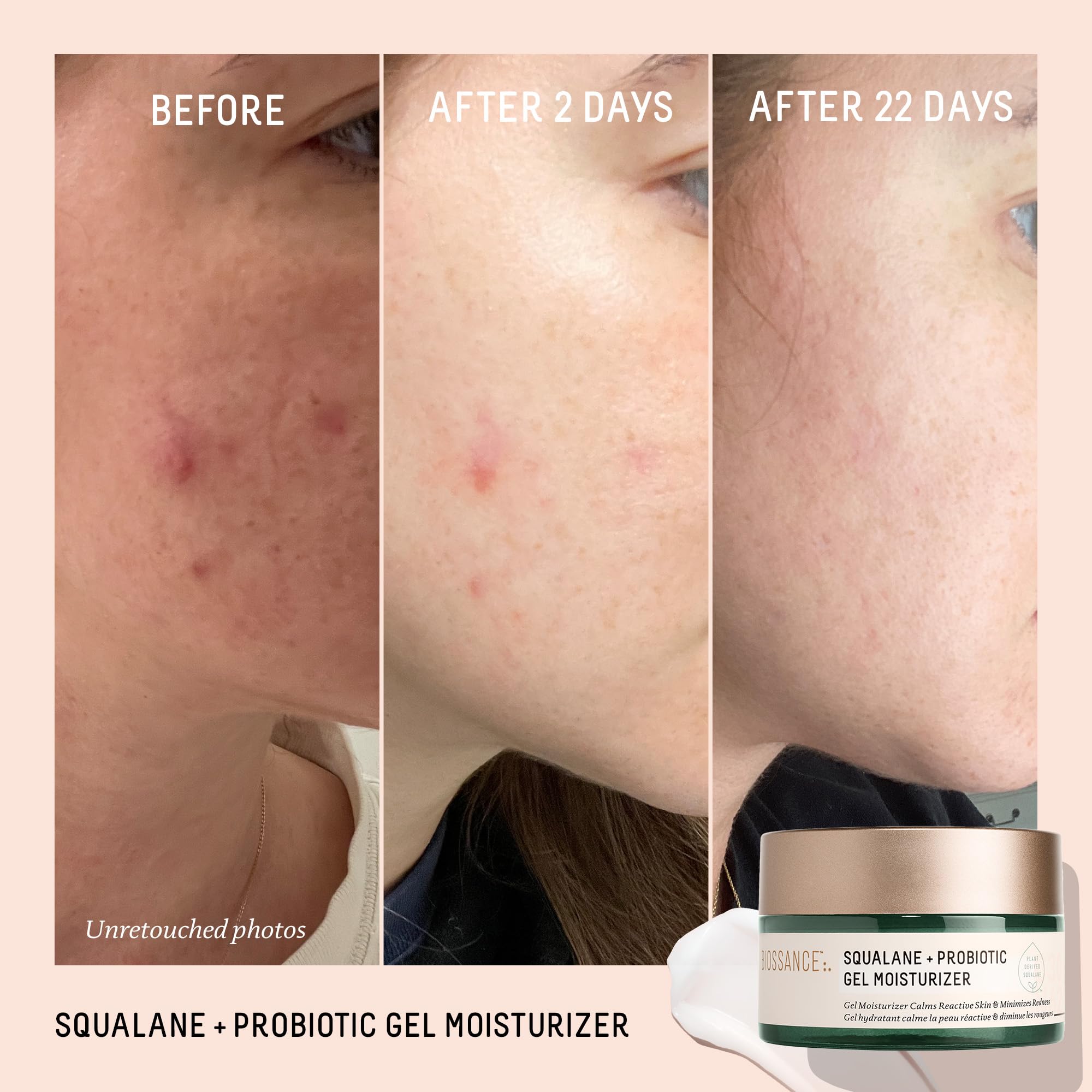 BIOSSANCE Squalane + Probiotic Balancing Face Gel Moisturizer | For Oily & Acne-Prone Skin