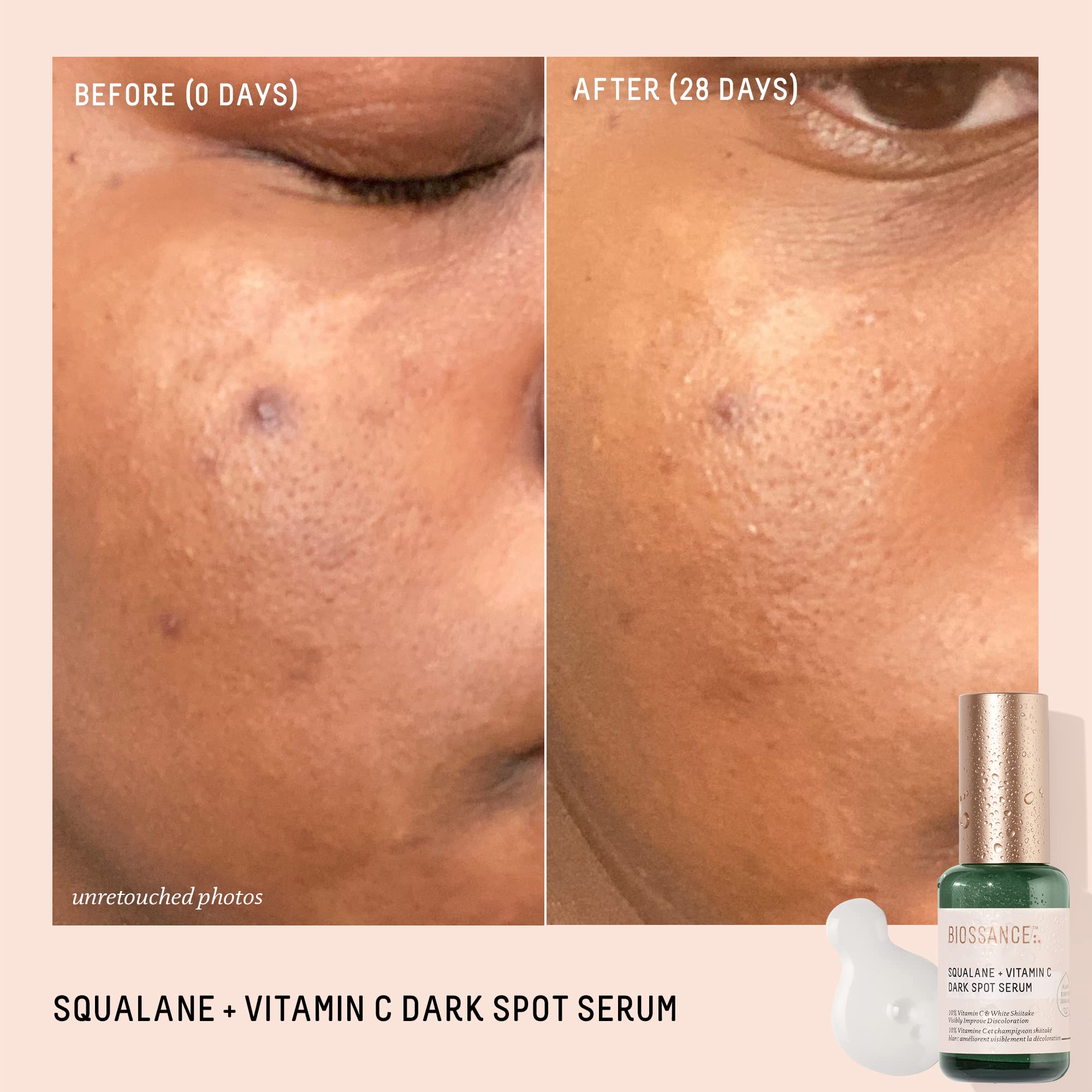 BIOSSANCE Squalane + Vitamin C Dark Spot Serum – 10% Vitamin C, White Shiitake, Fragrance-Free