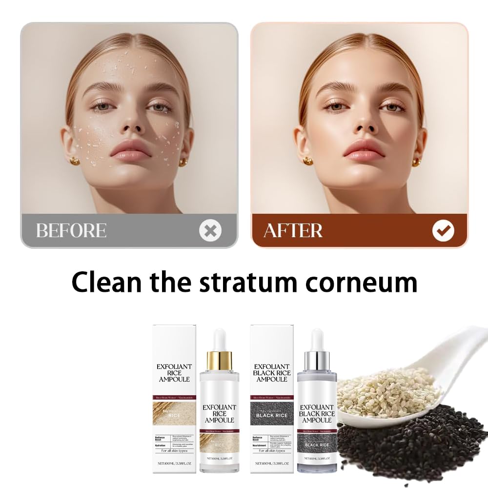 Black Rice Exfoliant – Gentle White & Black Rice Peel for All Skin Types (2-Piece)
