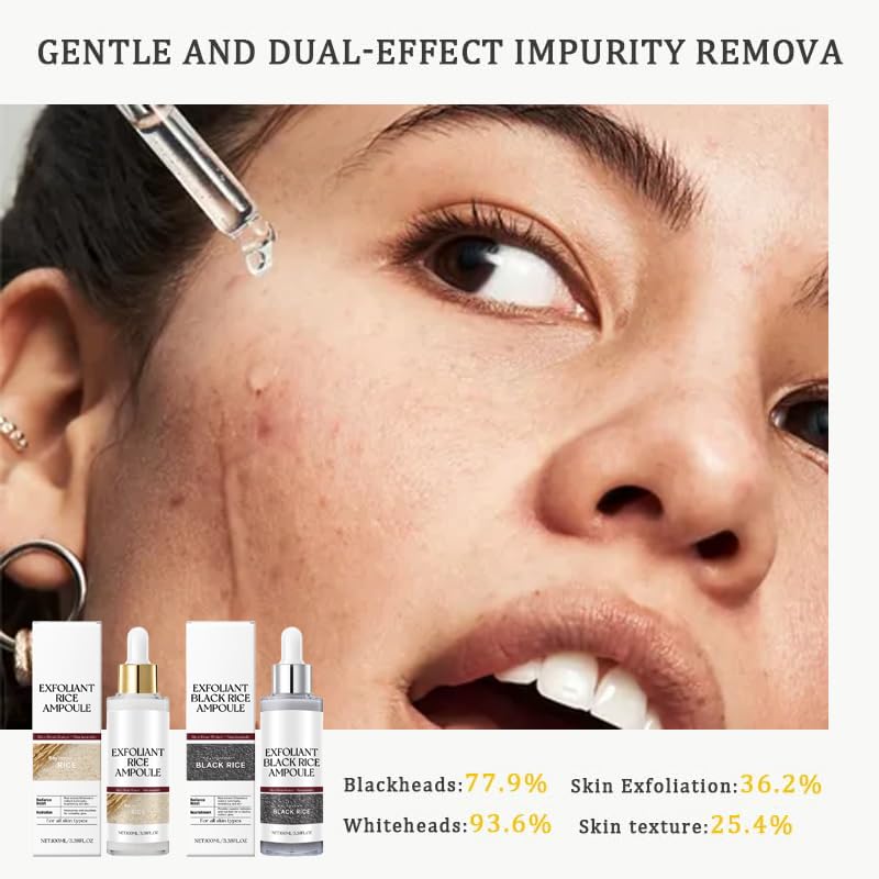 Black Rice Exfoliant – Gentle White & Black Rice Peel for All Skin Types (2-Piece)