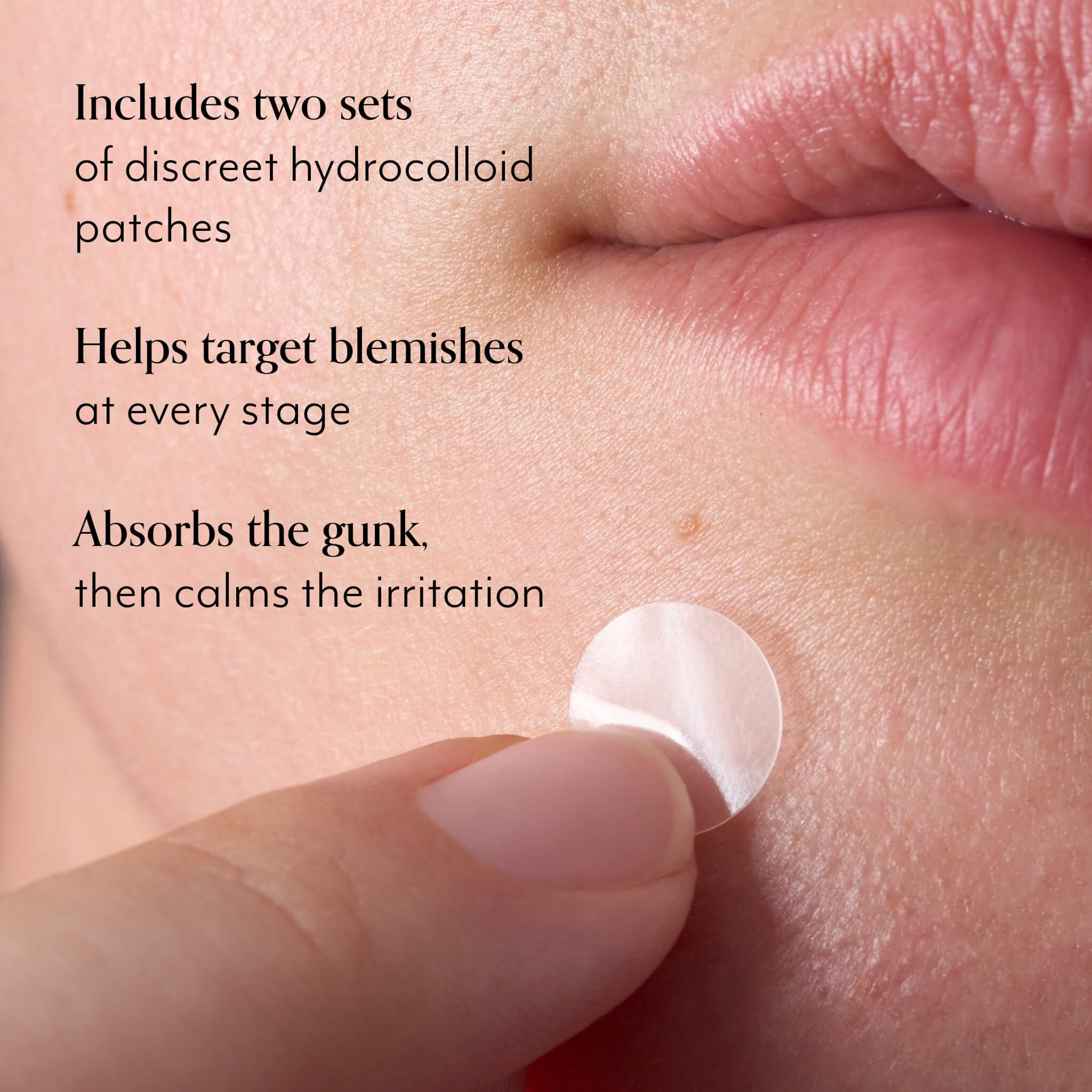 Bliss Clear Genius Blemish Patches – Salicylic Acid & Zinc for Fast Relief & Prevention, Clarifying Spot Treatment - 3 Pack