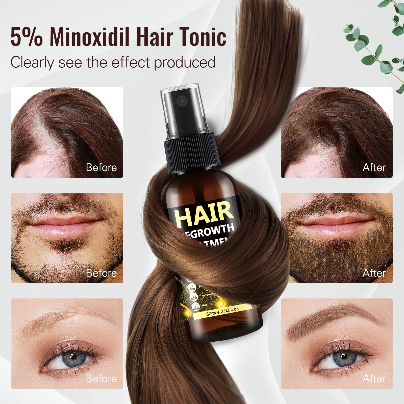 BLISSMATE 5% Minoxidil Hair Regrowth Spray for Men & Women | Thinning Hair & Beard Solution
