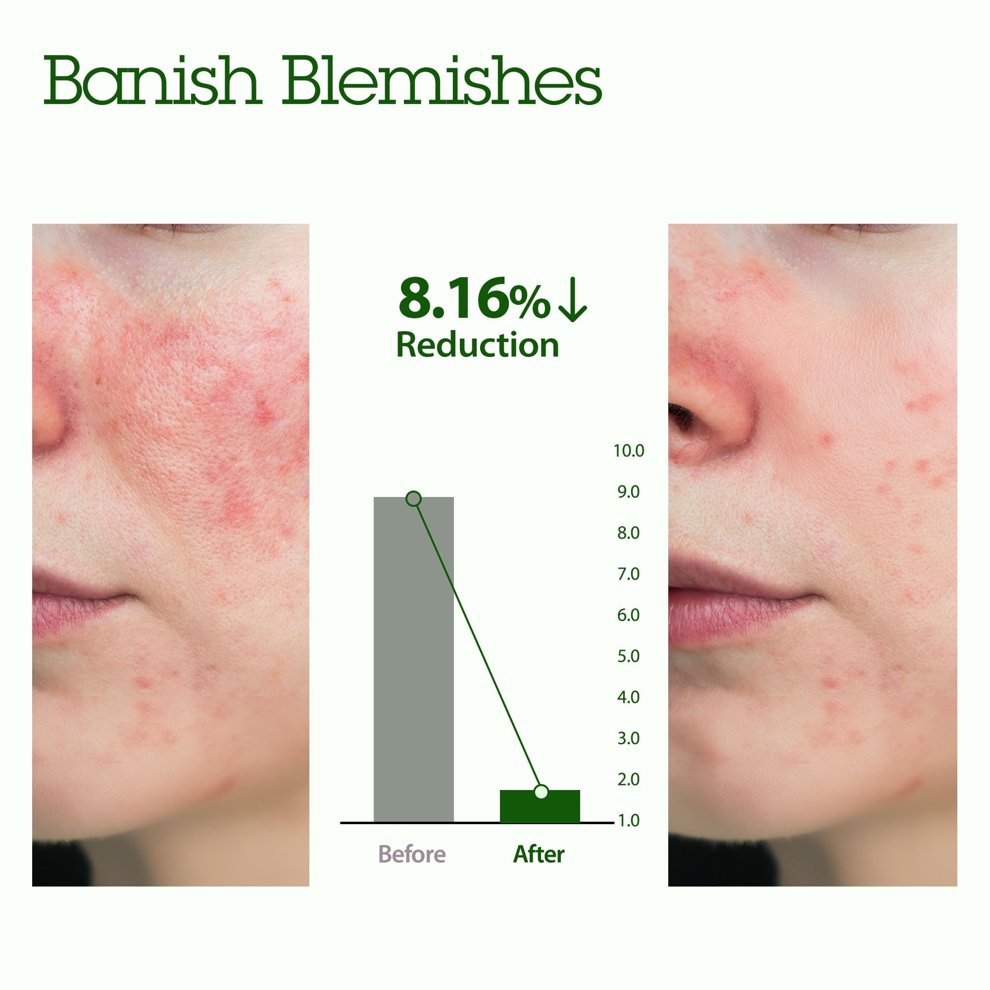 BLITHE Patting Splash Mask – Green Tea Lactic Acid Exfoliating Face Wash for Acne‑Prone Skin, Vegan, Pore Clarifying, 5.07 fl oz