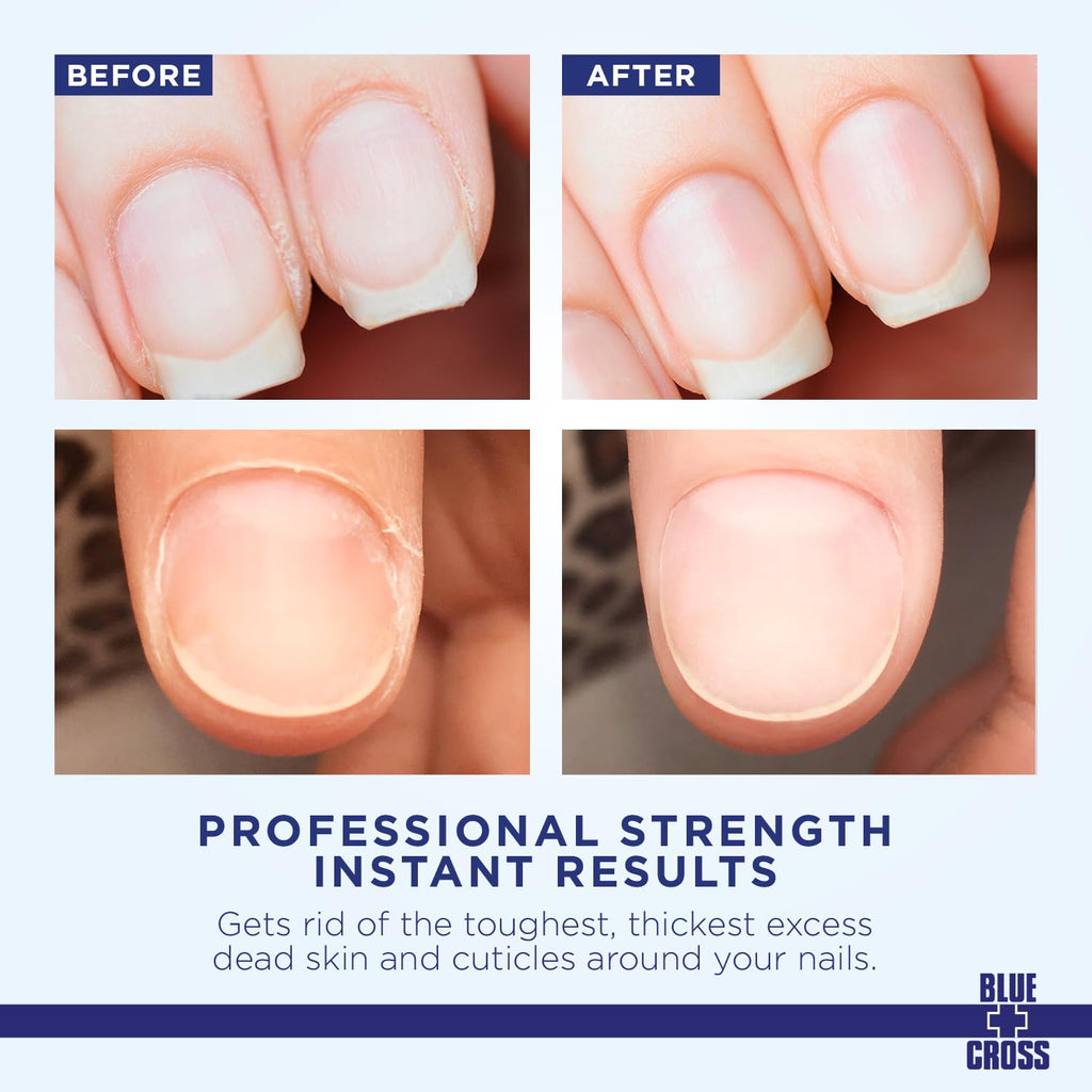 Blue Cross Cuticle Remover Cream & Nail Care Oil – 1oz Each, 2-Pack Gift Set, Made in USA