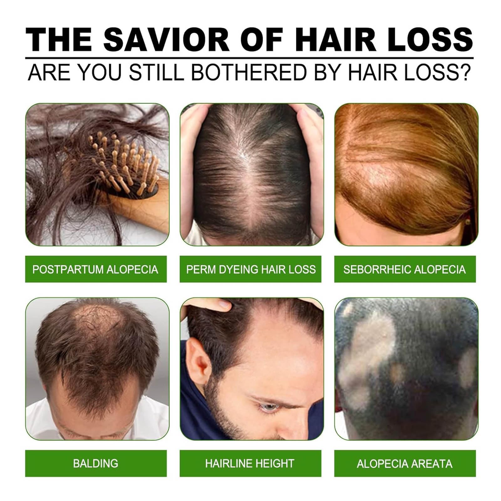 Boaccy Hair Regrowth System – Advanced Hair Growth Treatment with Ginseng, Eclipta Prostrata, Peppermint Oil & Ginger Root
