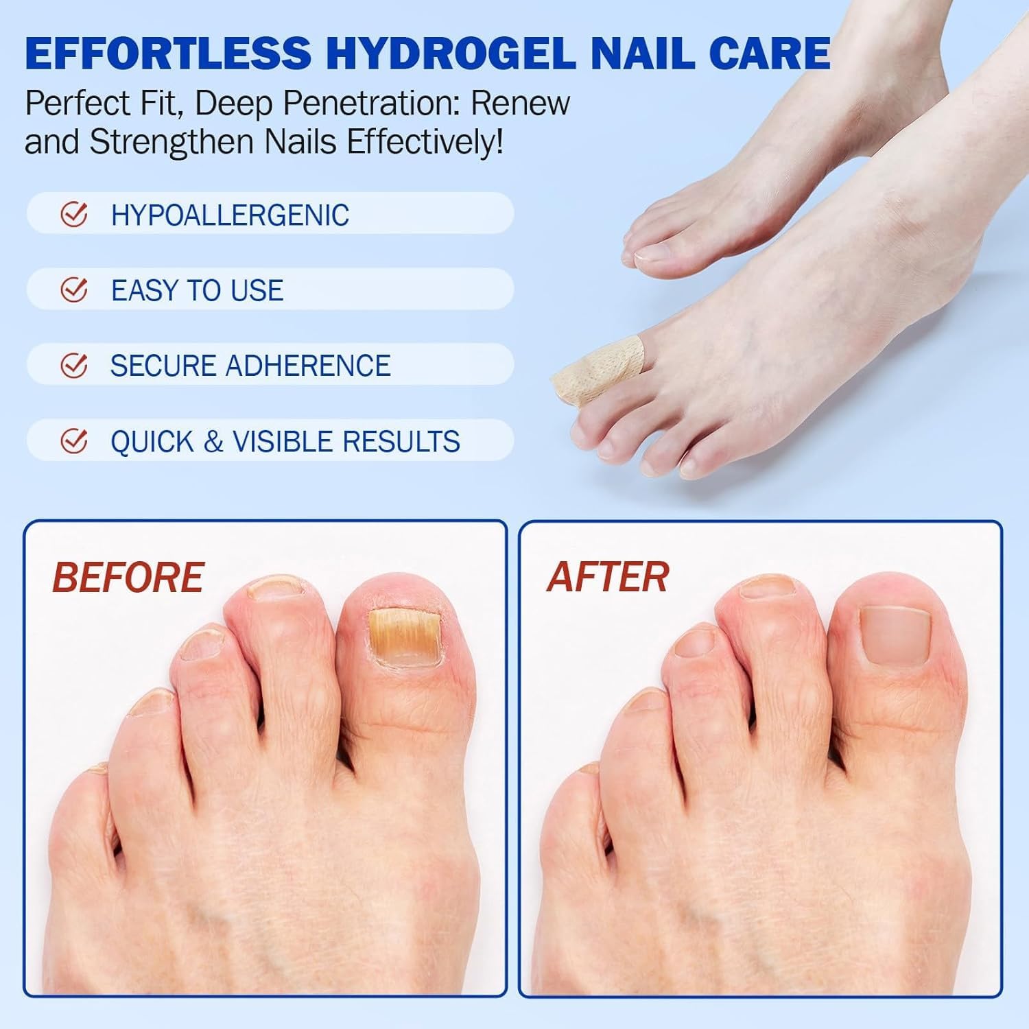 BOELIKAYS Fungal Nail Patches - Extra Strength Toenail Treatment (2pcs, Odorless)