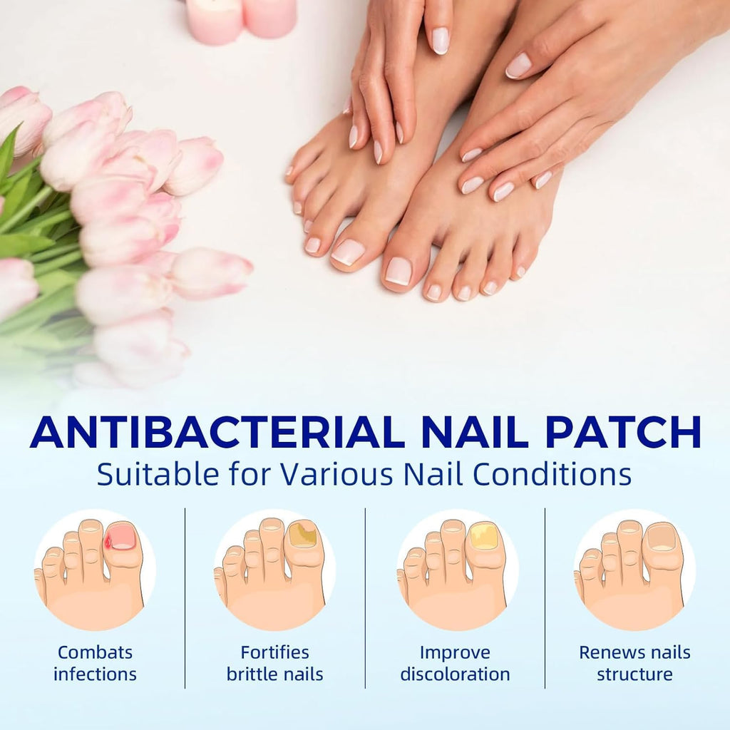 BOELIKAYS Fungal Nail Patches - Extra Strength Toenail Treatment (2pcs, Odorless)