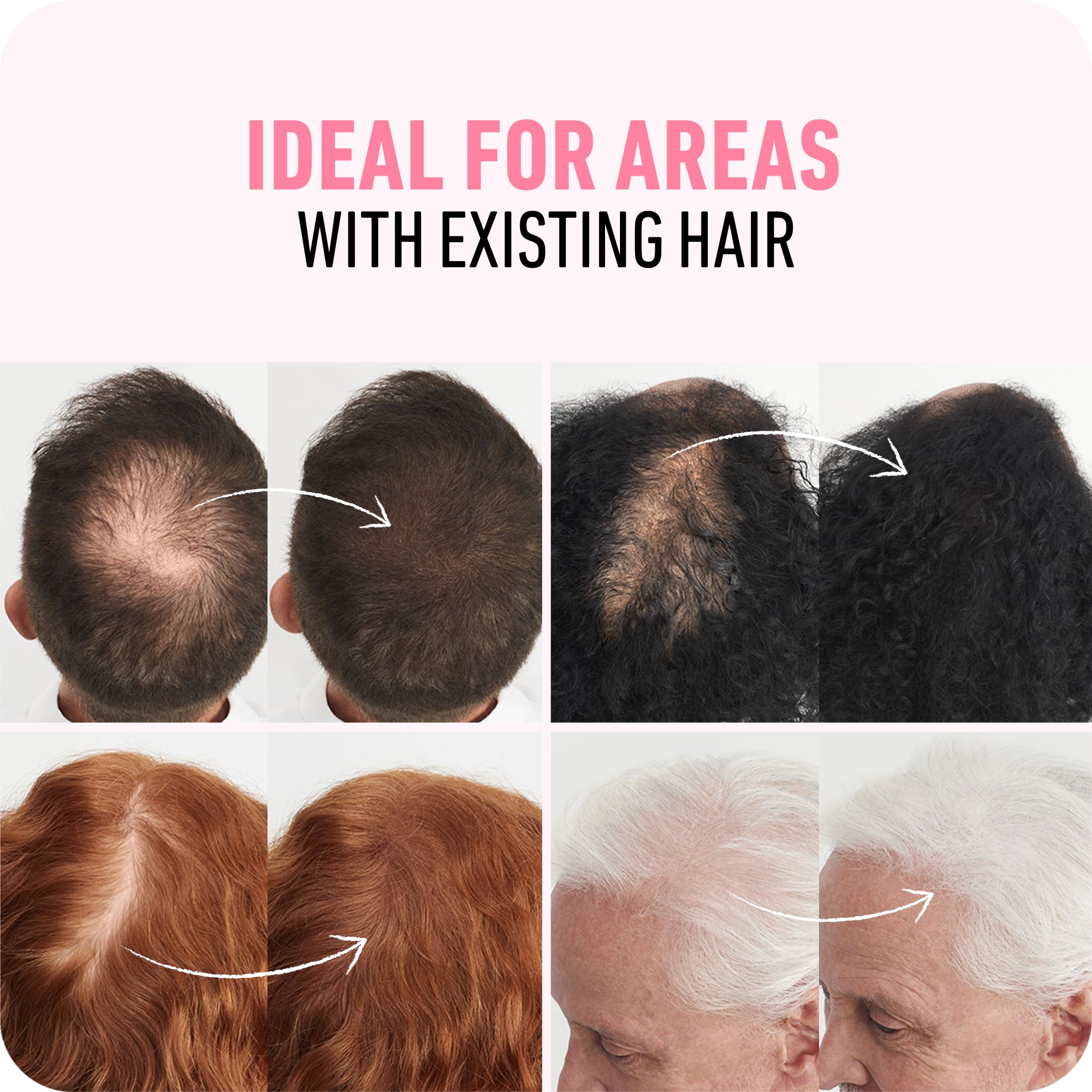 Boldify Hair Fibers (2 x 56g) – Instantly Fuller Hair in 14 Shades for Women & Men – Dark Brown