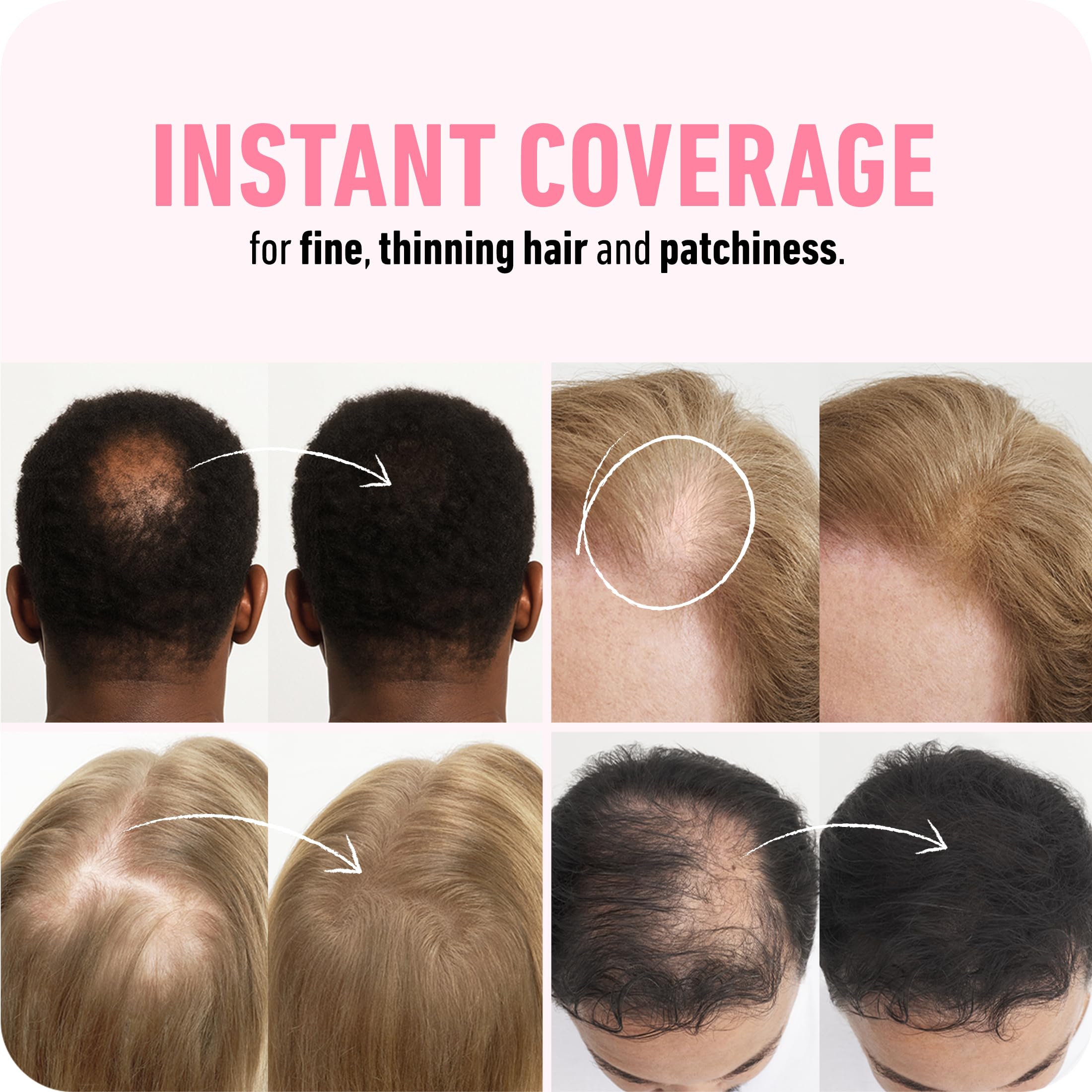 Boldify Hair Fibers (2x56g) – Instant Fuller Look for Thinning Hair (14 Shades) – Black