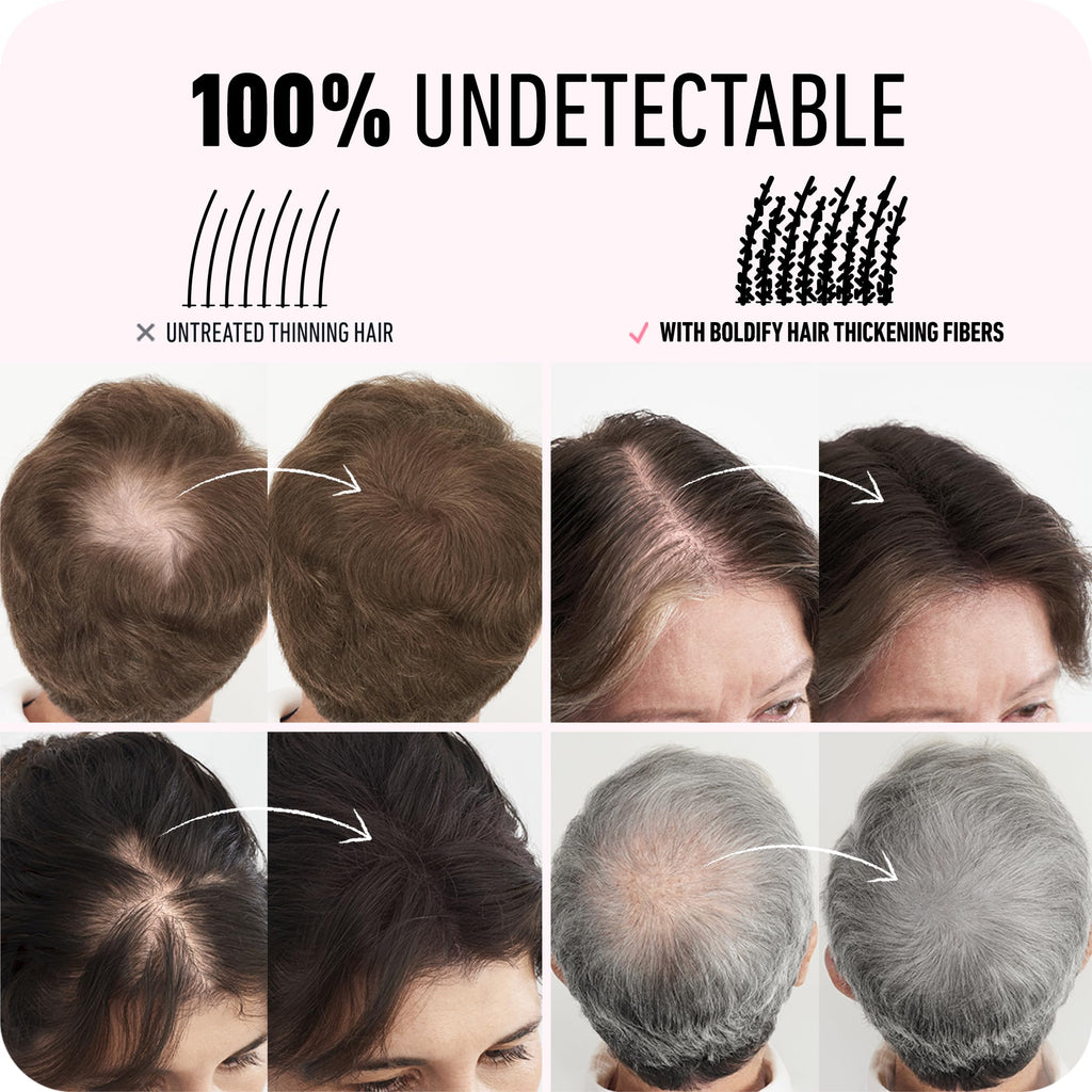 Boldify Hair Fibers (2 x 56g) – Instantly Fuller Hair in 14 Shades for Women & Men – Dark Brown