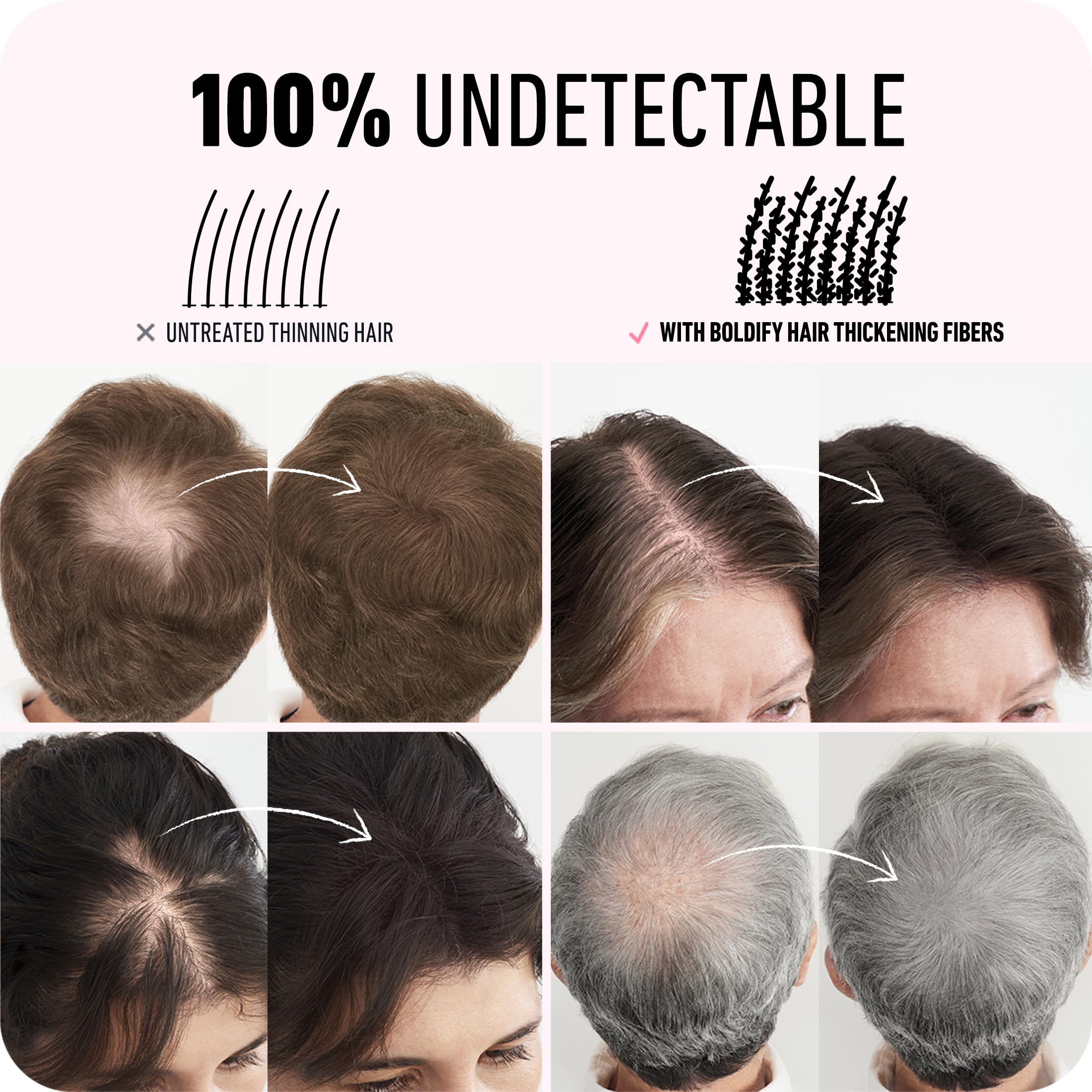 Boldify Hair Fibers (2 x 56g) – Instantly Fuller Hair in 14 Shades for Women & Men – Dark Brown
