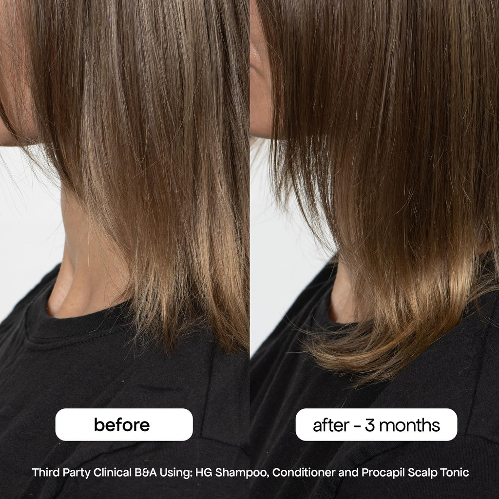 BondiBoost HG Anti-Thinning Shampoo & Conditioner Set – Fuller-Looking Hair, Procapil, Redensyl, Rosemary, Sulfate-Free