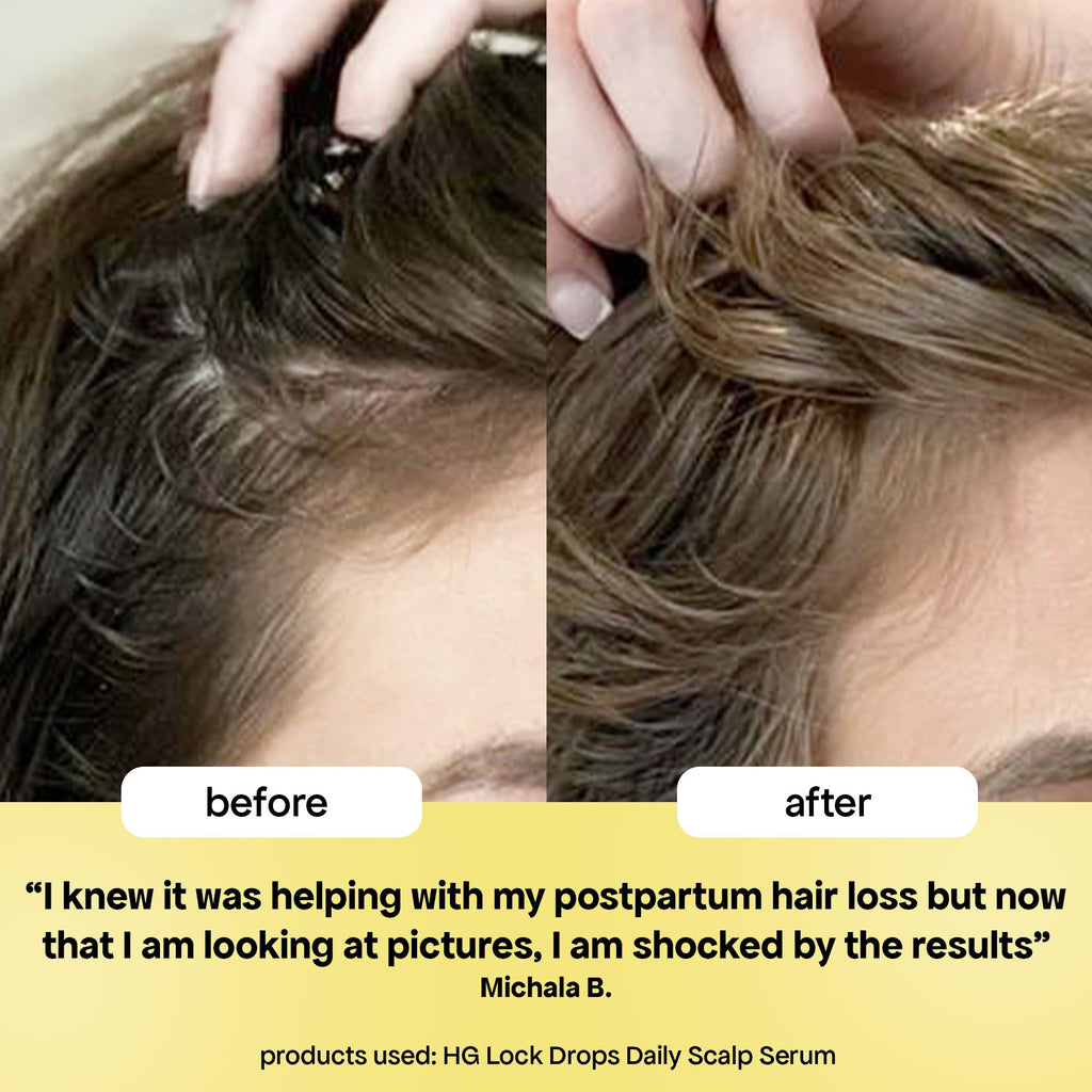 BondiBoost HG Lock Drops Daily Hair Serum for Women – Non-Greasy, Color-Safe & Thicker-Looking Hair