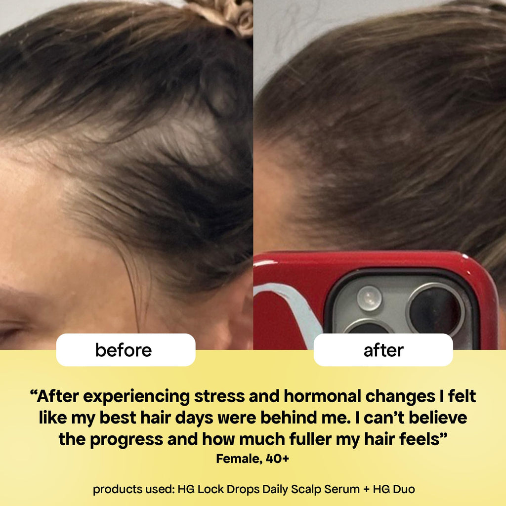 BondiBoost HG Lock Drops Daily Hair Serum for Women – Non-Greasy, Color-Safe & Thicker-Looking Hair