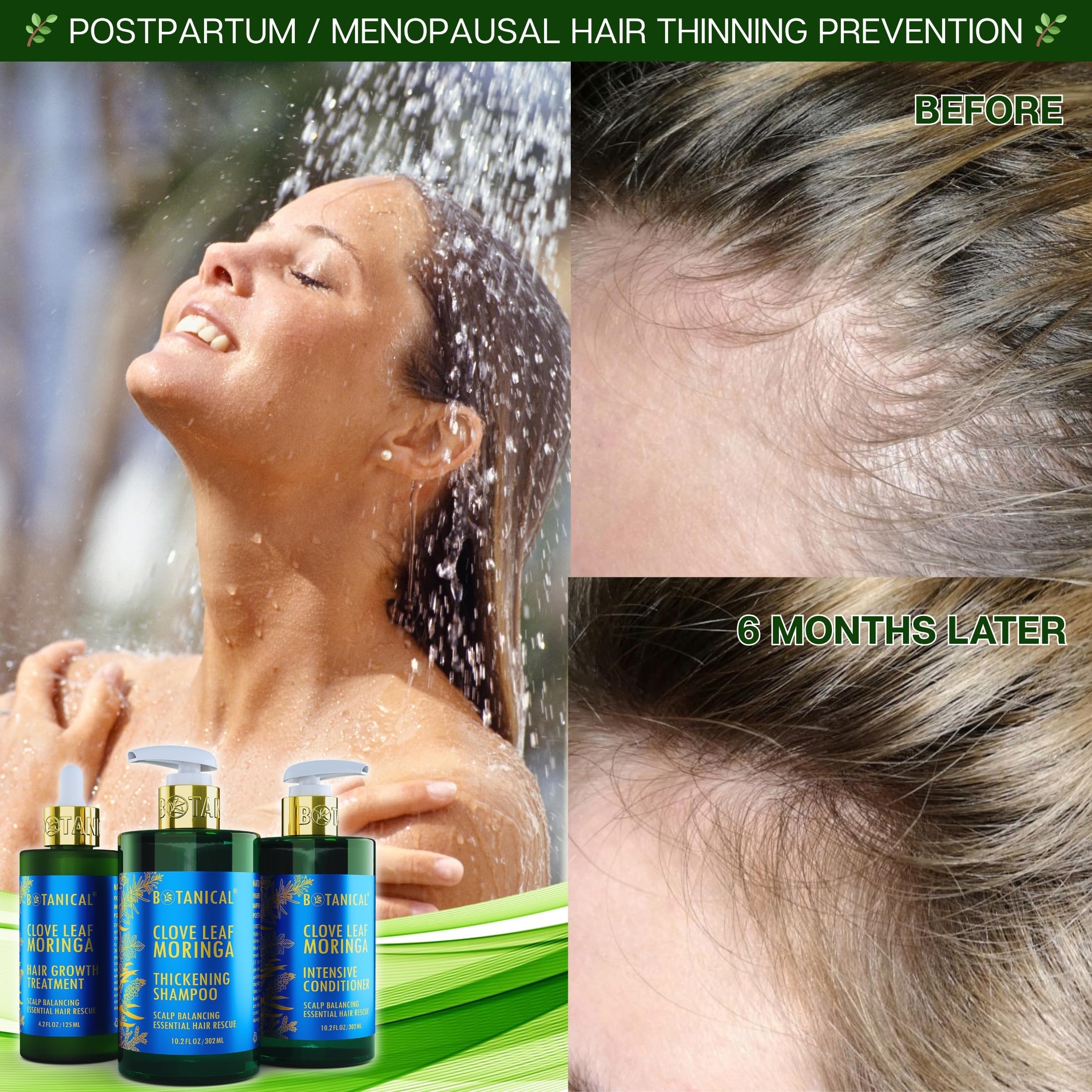Botanical Hair Growth Lab Moringa Shampoo with Saw Palmetto – Scalp Balancing Thickening Shampoo for Hair Loss & Thinning