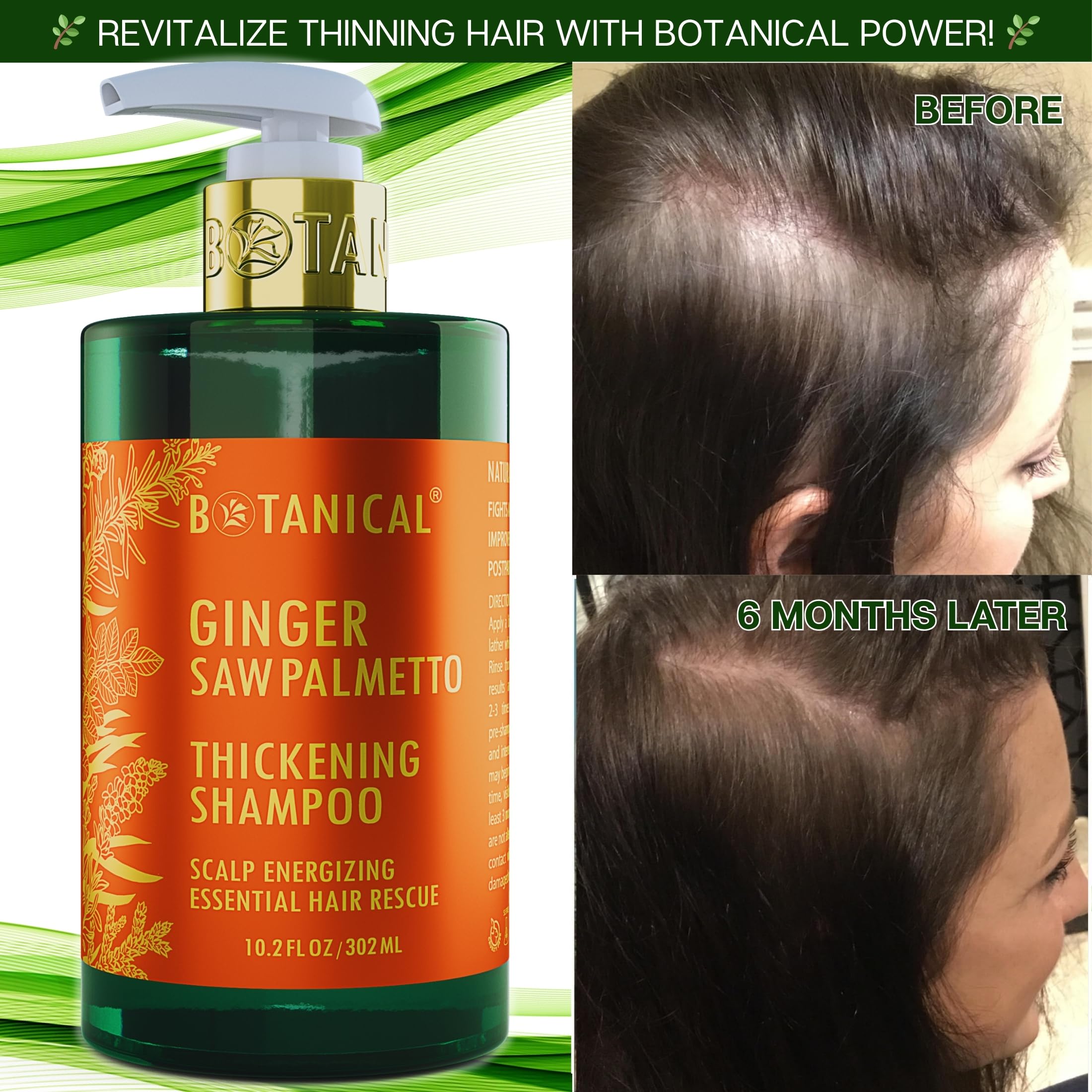 Botanical Hair Growth Lab Ginger Shampoo with Saw Palmetto – Scalp Energizing Thickening, 10.2 fl oz