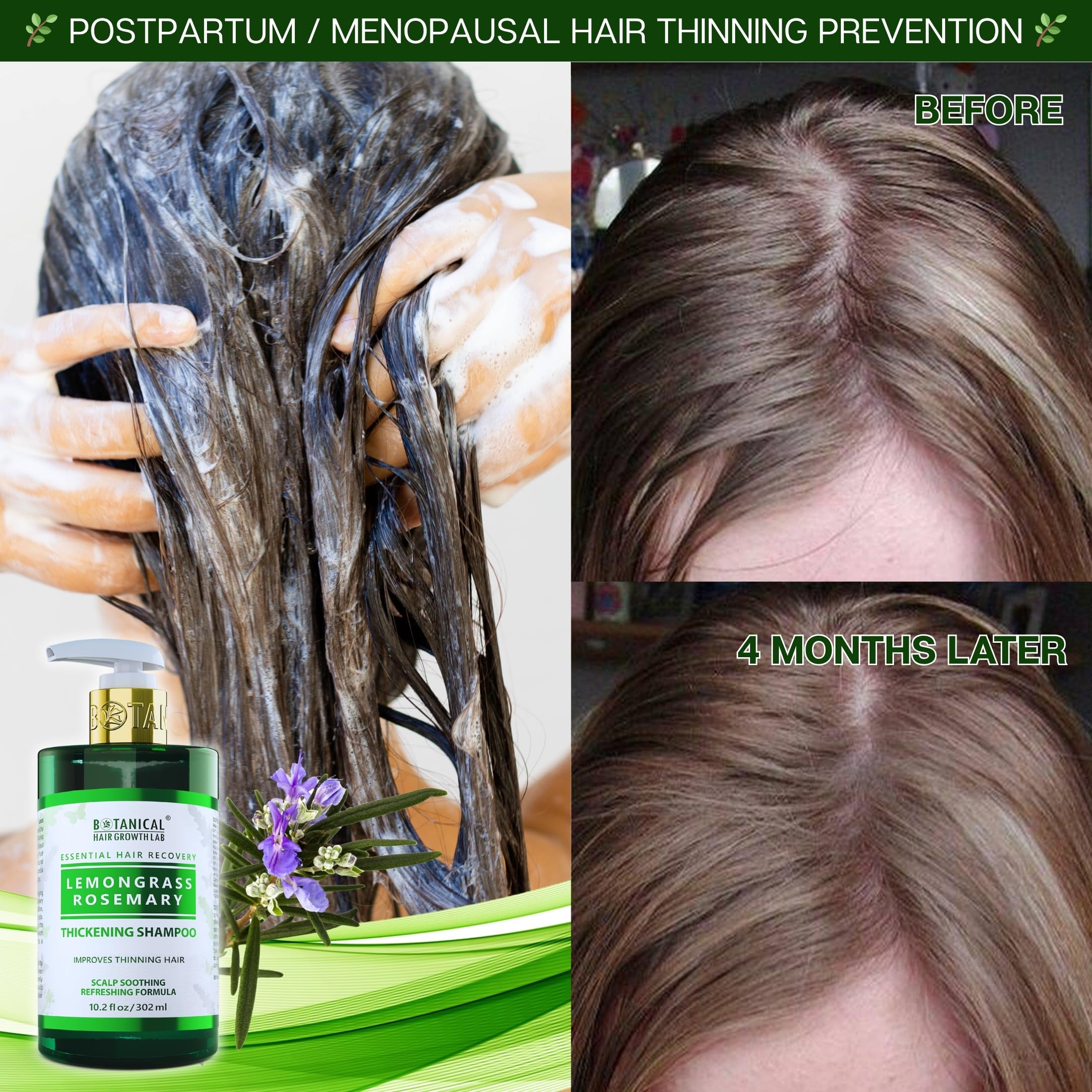 BOTANICAL HAIR GROWTH LAB Rosemary Shampoo with Saw Palmetto – Thickening & Scalp Stimulation, 10.2 oz