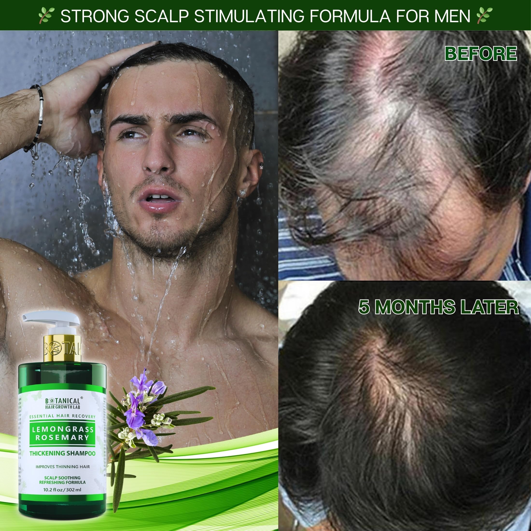BOTANICAL HAIR GROWTH LAB Rosemary Shampoo with Saw Palmetto – Thickening & Scalp Stimulation, 10.2 oz