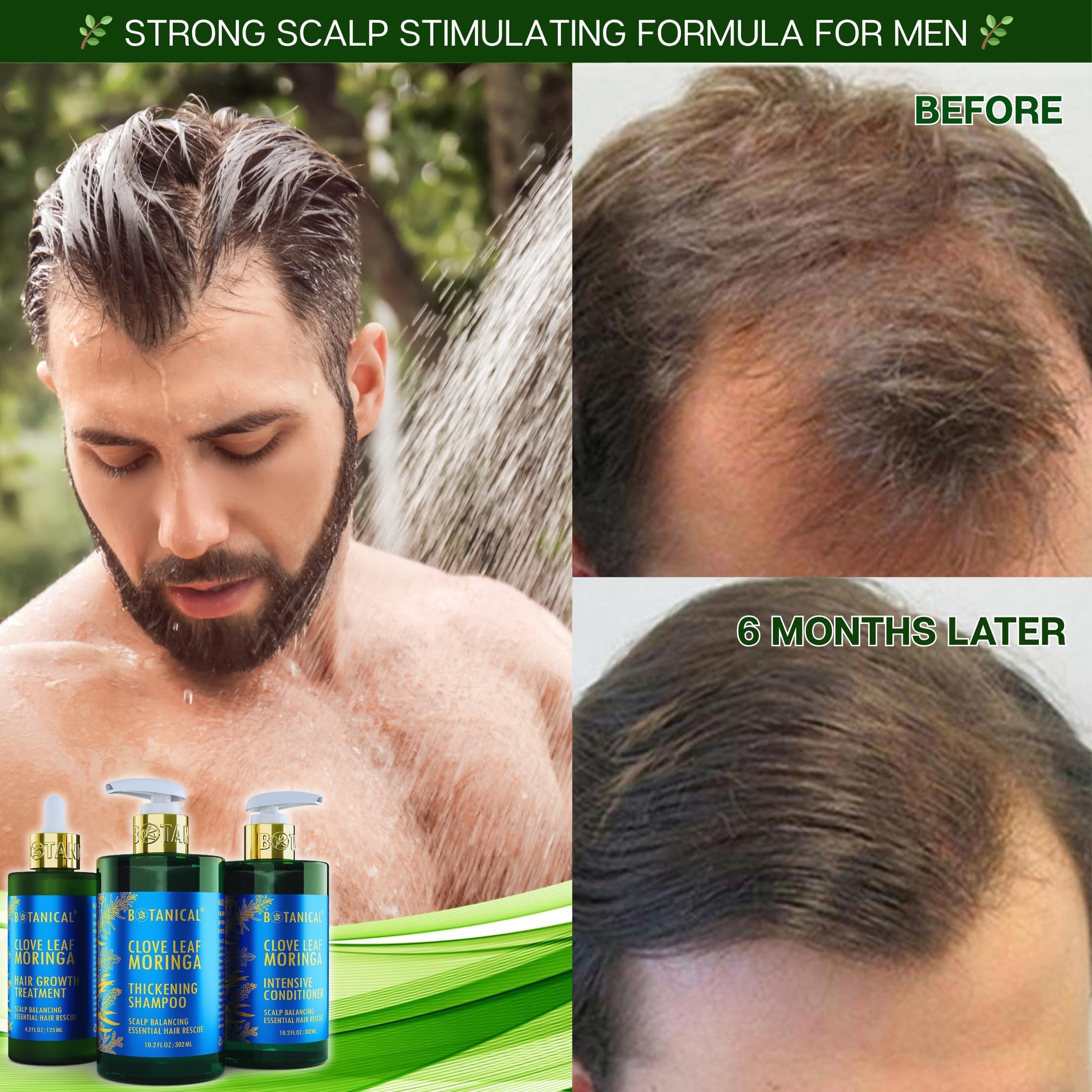 Botanical Hair Growth Lab Moringa Shampoo with Saw Palmetto – Scalp Balancing Thickening Shampoo for Hair Loss & Thinning